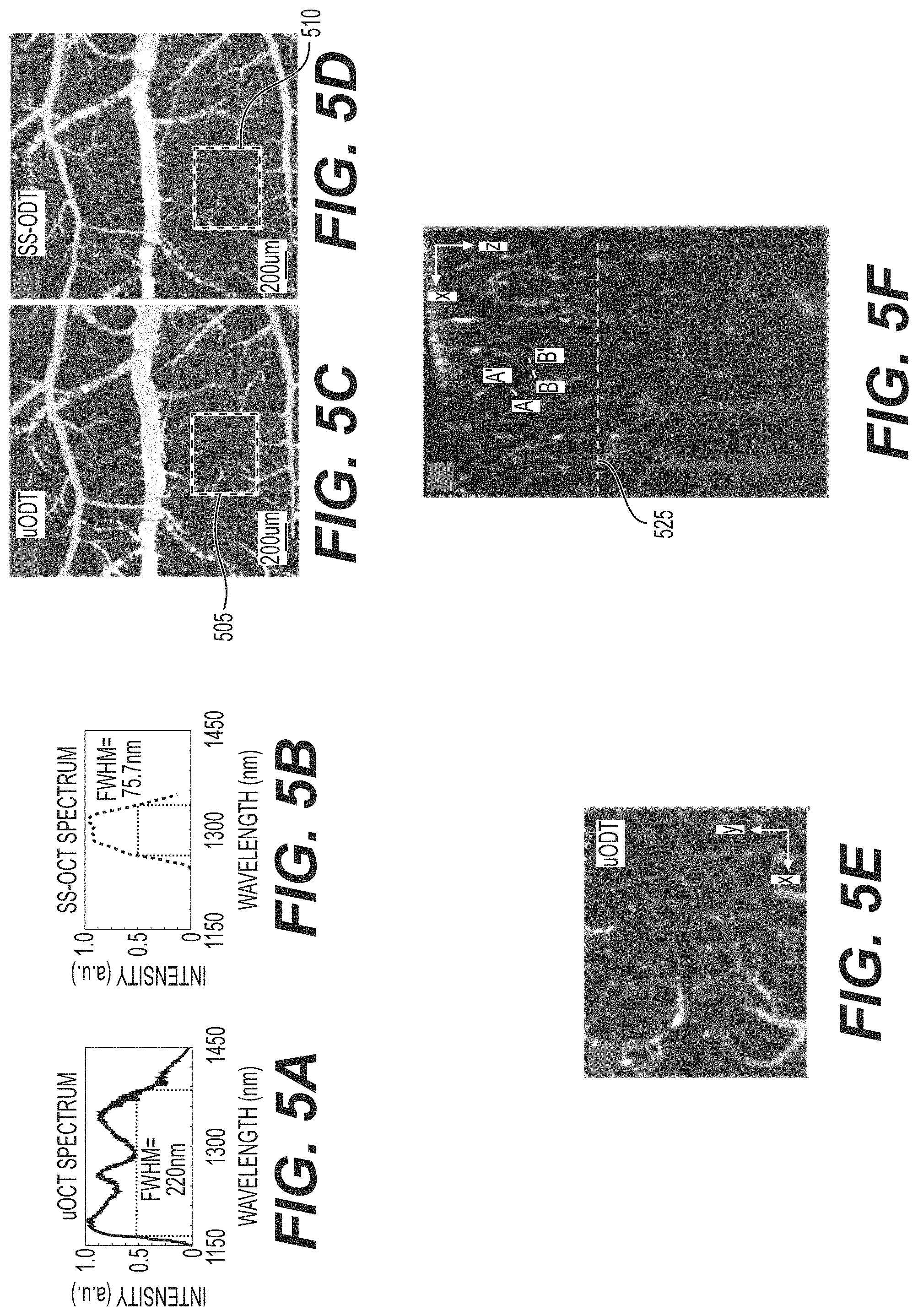 Patent US11771321 Figure 5 – System, method, and computer-accessible medium for subsurface capillary flow imaging by wavelength-division-multiplexing swept-source optical doppler tomography