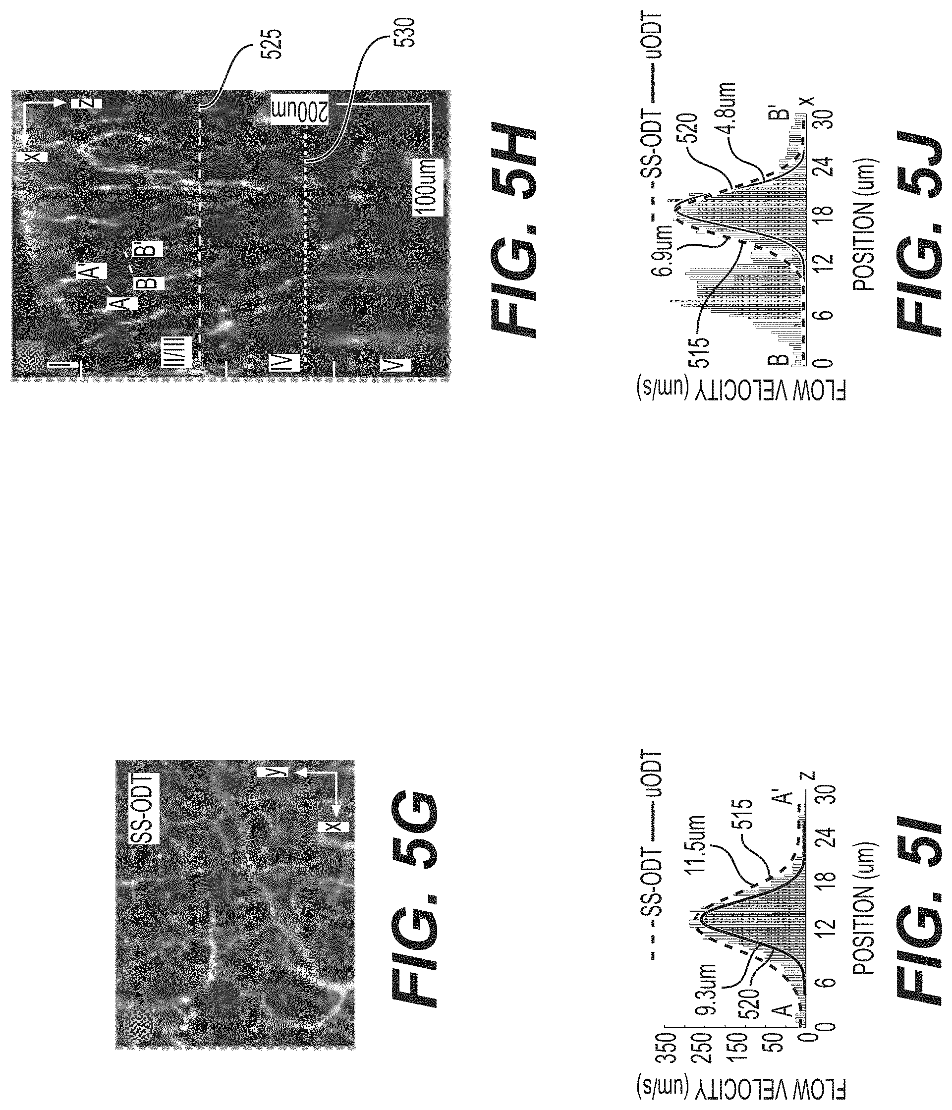 Patent US11771321 Figure 6 – System, method, and computer-accessible medium for subsurface capillary flow imaging by wavelength-division-multiplexing swept-source optical doppler tomography