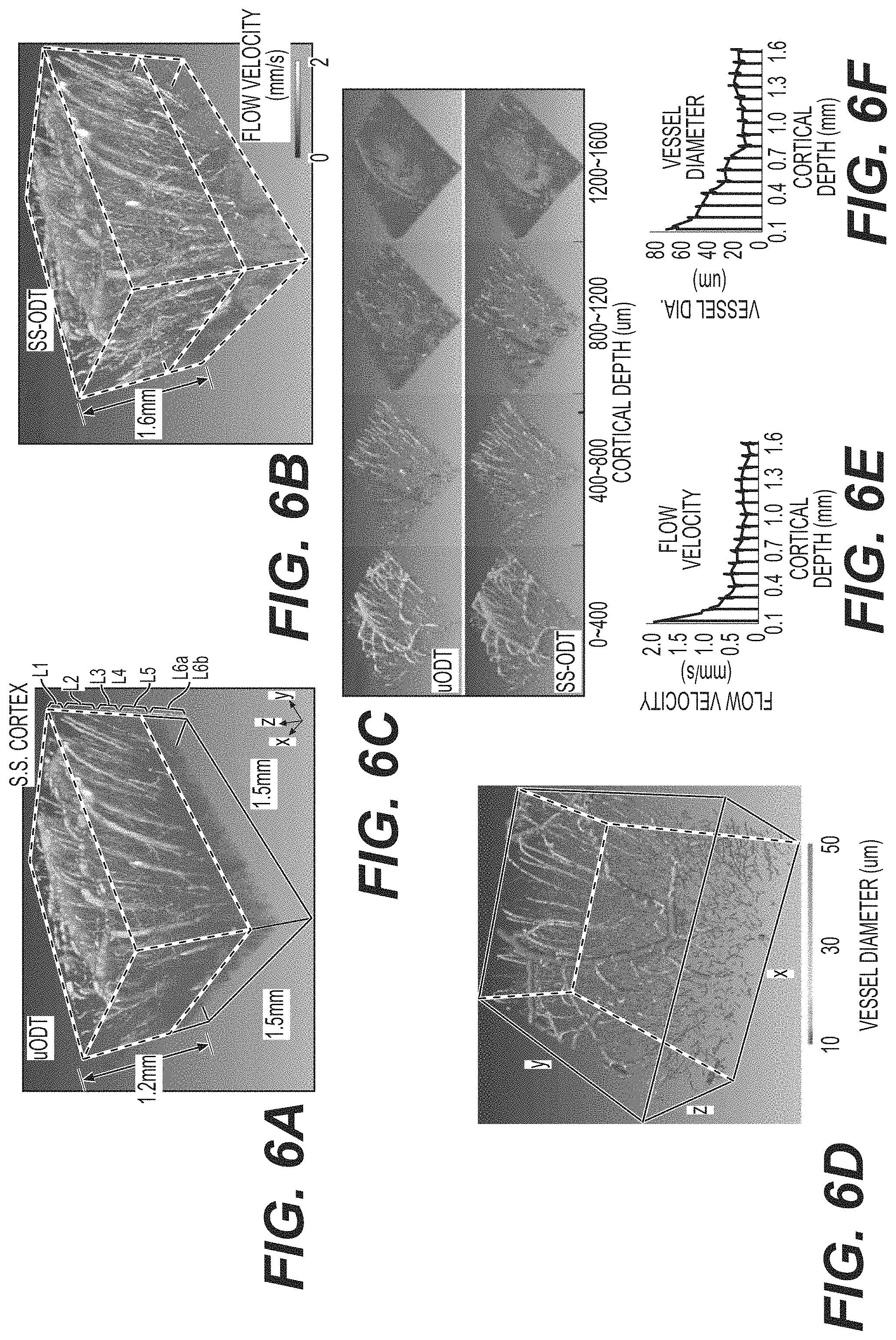 Patent US11771321 Figure 7 – System, method, and computer-accessible medium for subsurface capillary flow imaging by wavelength-division-multiplexing swept-source optical doppler tomography