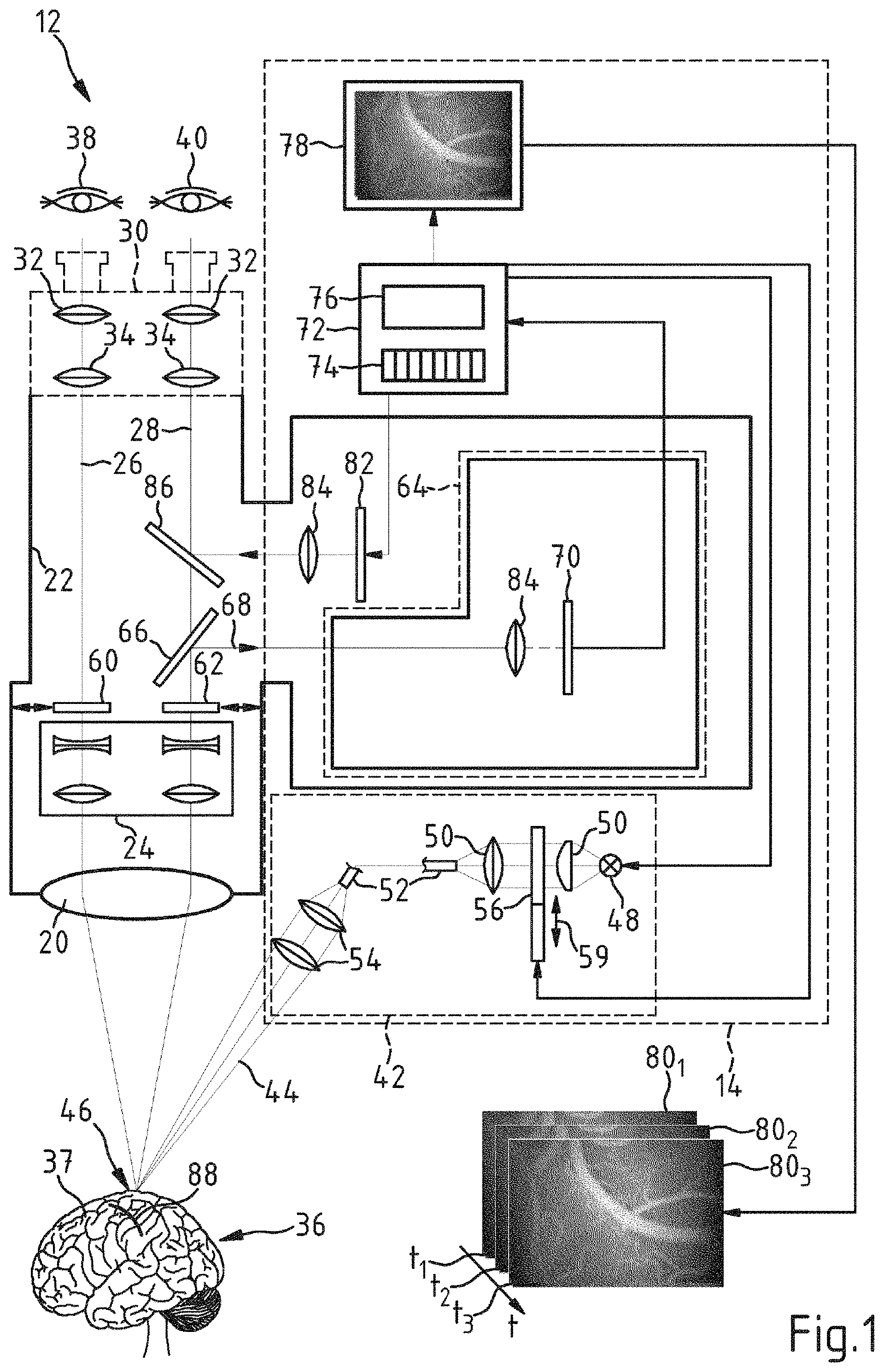 Patent US11771322 Figure 1 – Computer-implemented method, computer program and surgical system for determining the volumetric flow rate of blood through a portion of a blood vessel in a surgical field