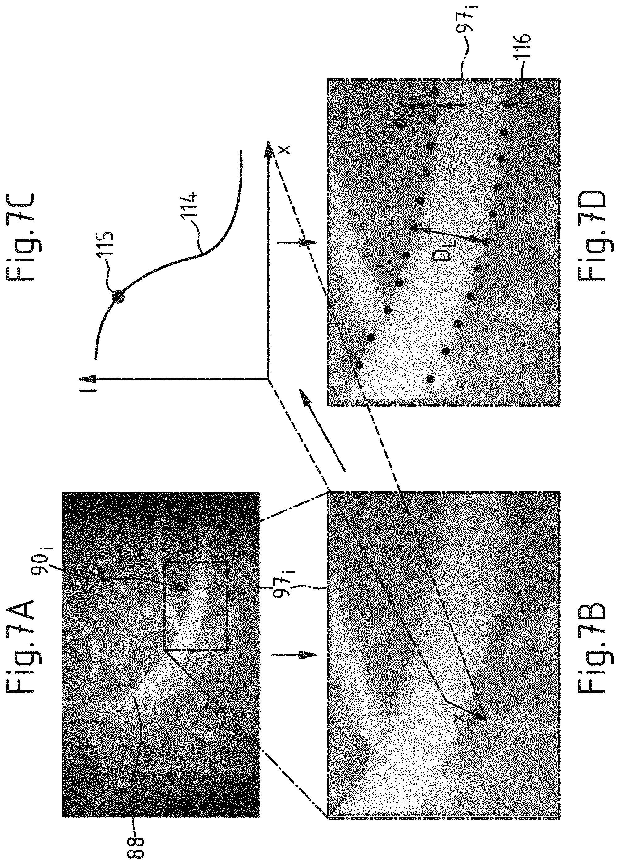 Patent US11771322 Figure 6 – Computer-implemented method, computer program and surgical system for determining the volumetric flow rate of blood through a portion of a blood vessel in a surgical field