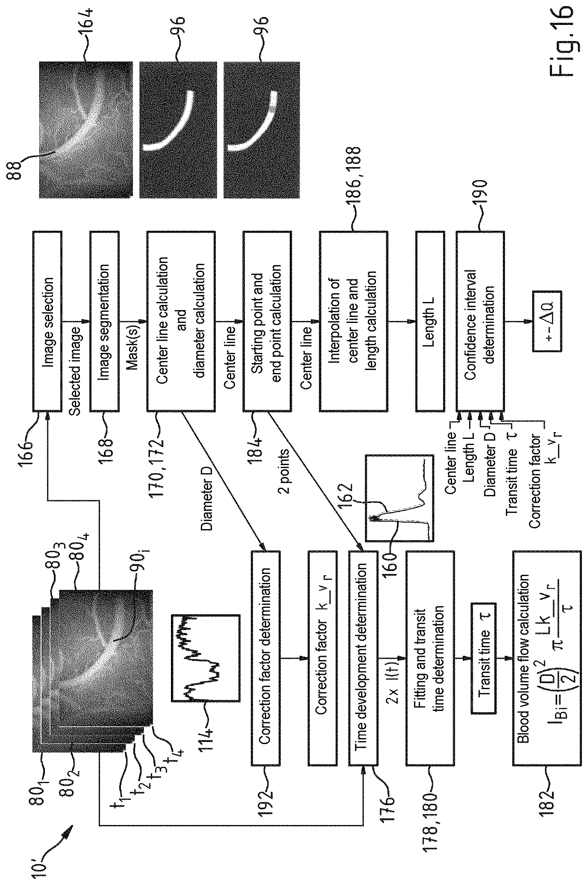 Patent US11771322 Figure 13 – Computer-implemented method, computer program and surgical system for determining the volumetric flow rate of blood through a portion of a blood vessel in a surgical field