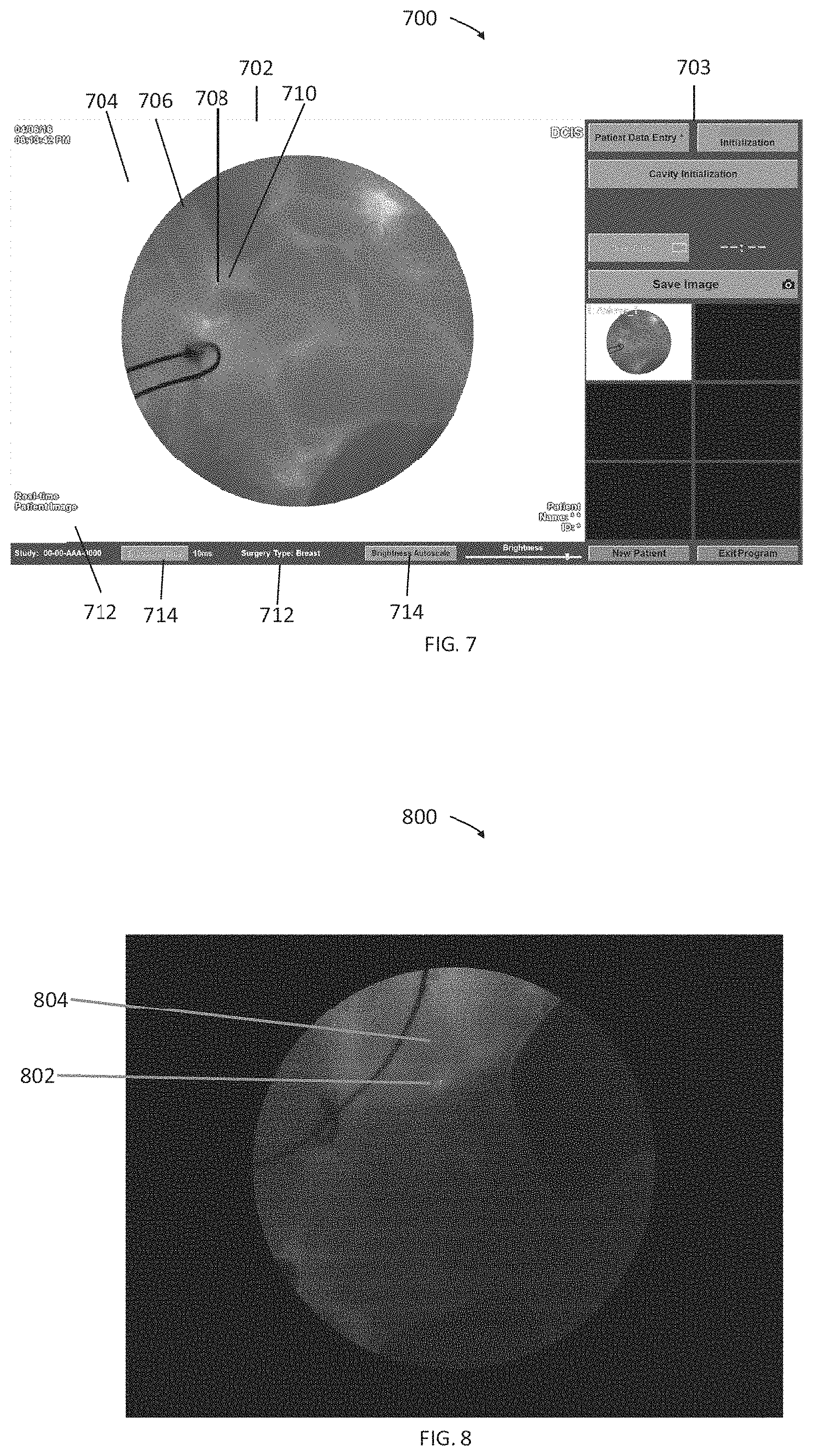 Patent US11771324 Figure 7 – System and method for residual cancer cell detection