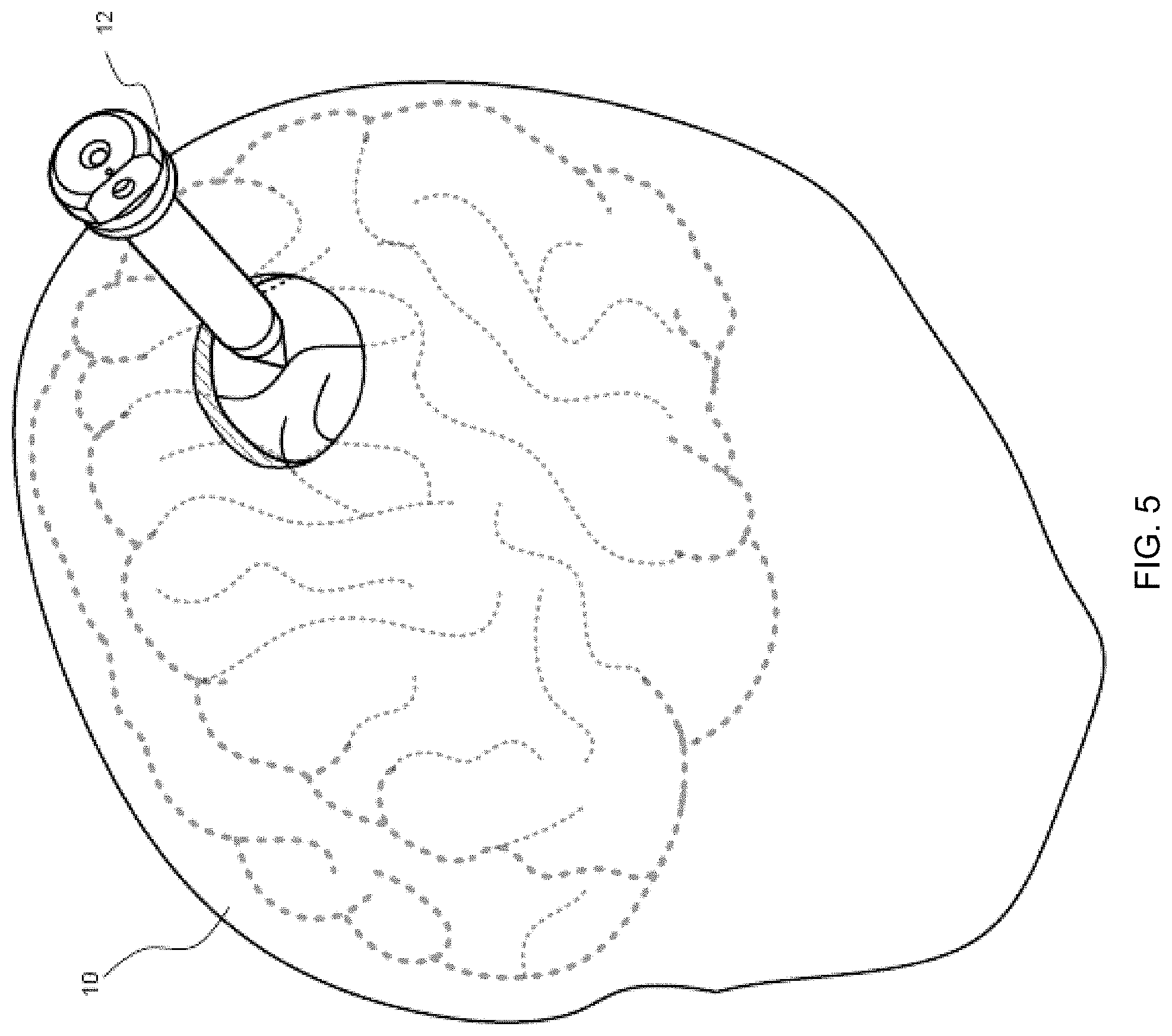 Patent US11771325 Figure 5 – Multispectral synchronized imaging