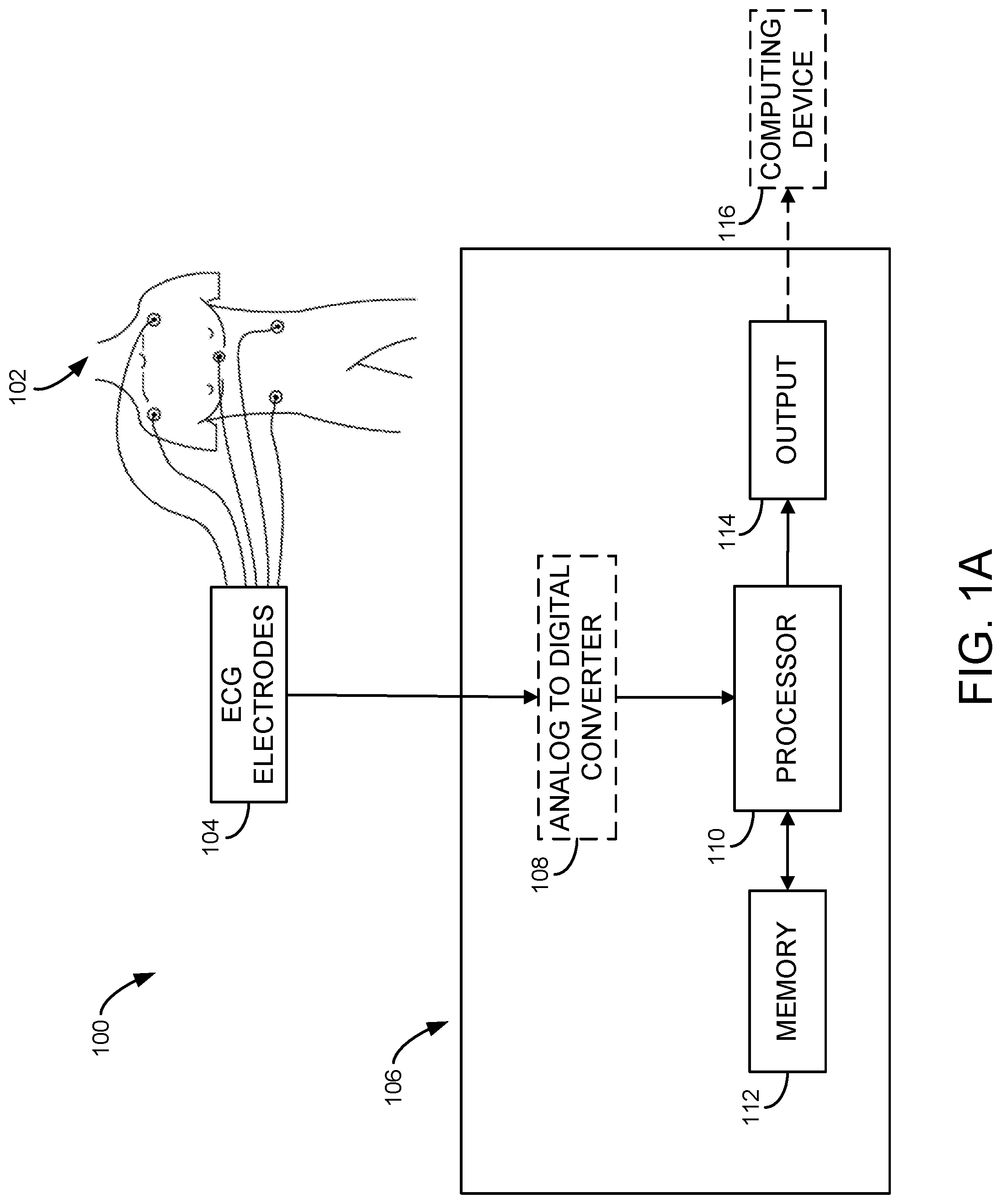 Patent US11771330 Figure 1 – System and method for processing cardiac signals and providing reports to users regarding impending or ongoing medical conditions