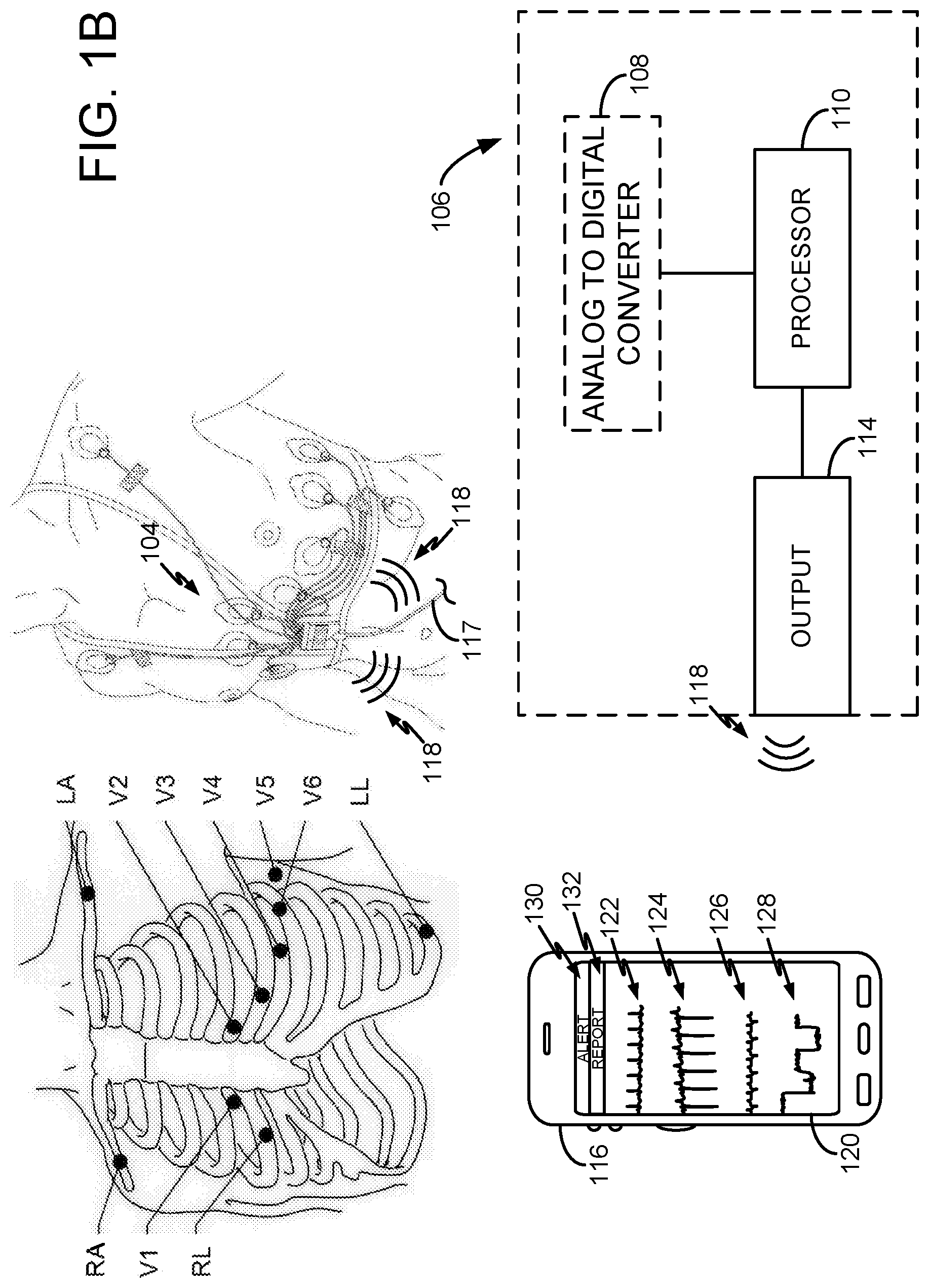 Patent US11771330 Figure 2 – System and method for processing cardiac signals and providing reports to users regarding impending or ongoing medical conditions