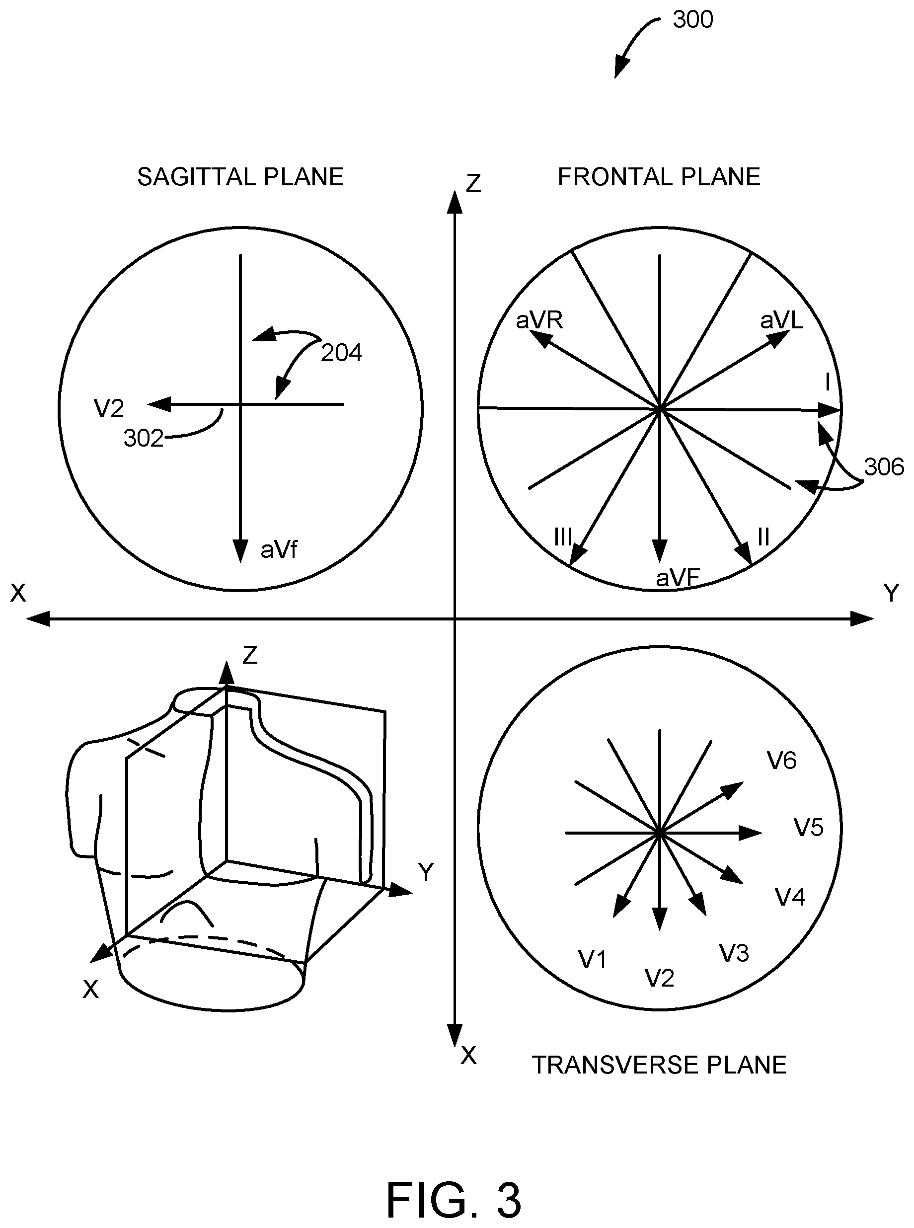 Patent US11771330 Figure 5 – System and method for processing cardiac signals and providing reports to users regarding impending or ongoing medical conditions