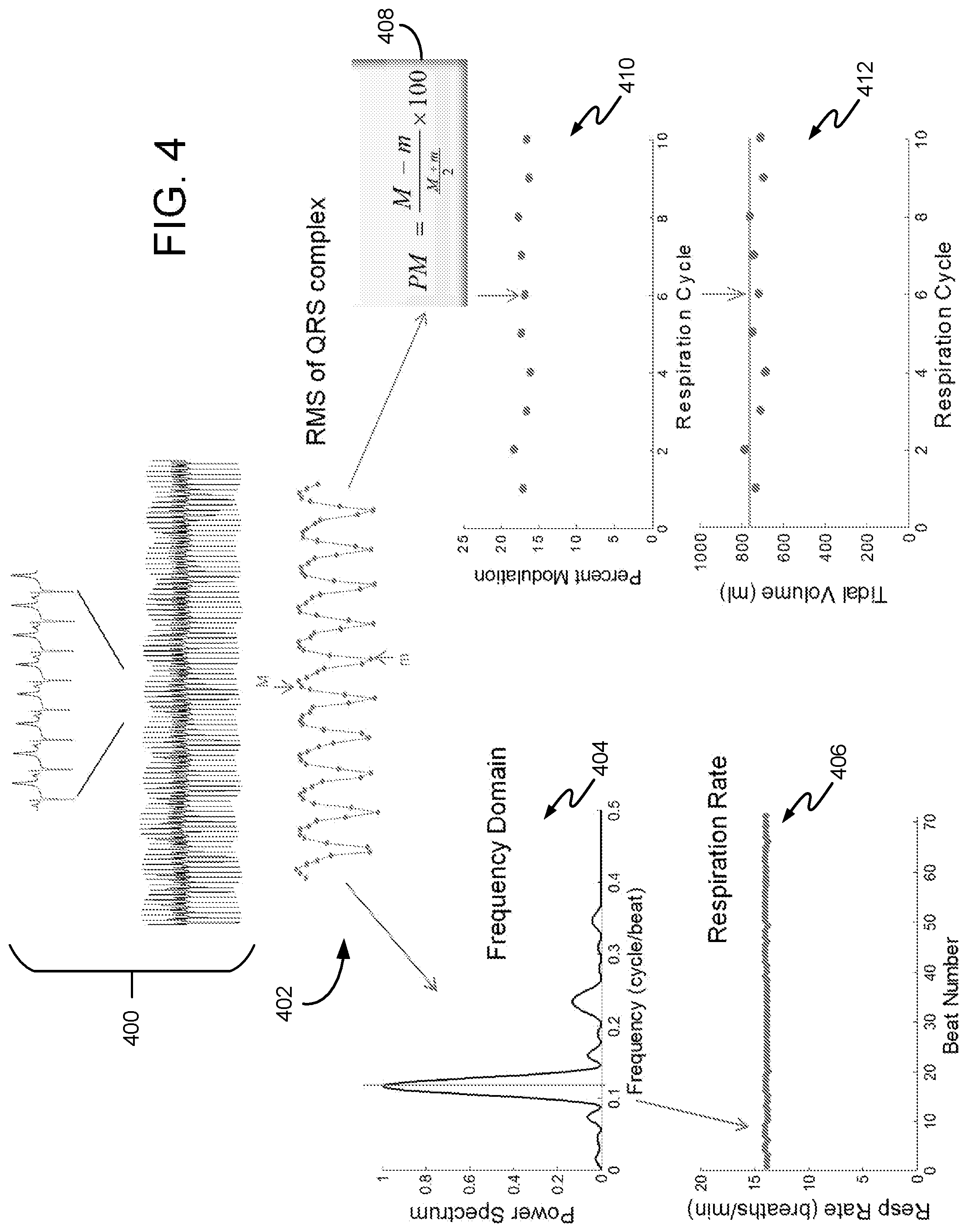 Patent US11771330 Figure 6 – System and method for processing cardiac signals and providing reports to users regarding impending or ongoing medical conditions