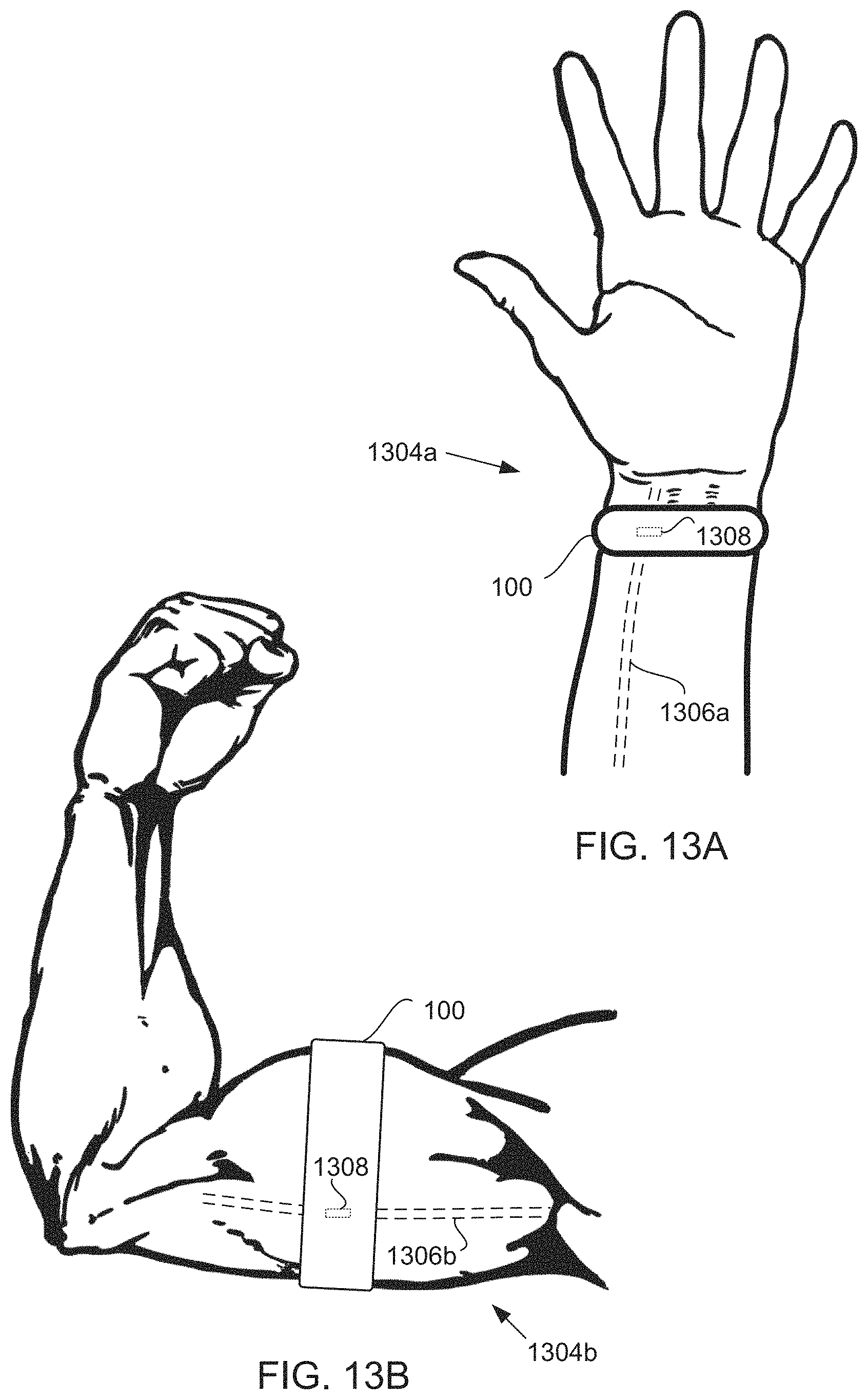 Patent US11771334 Figure 20 – Methods and devices for aligning miniaturized impedance sensors in wearable devices