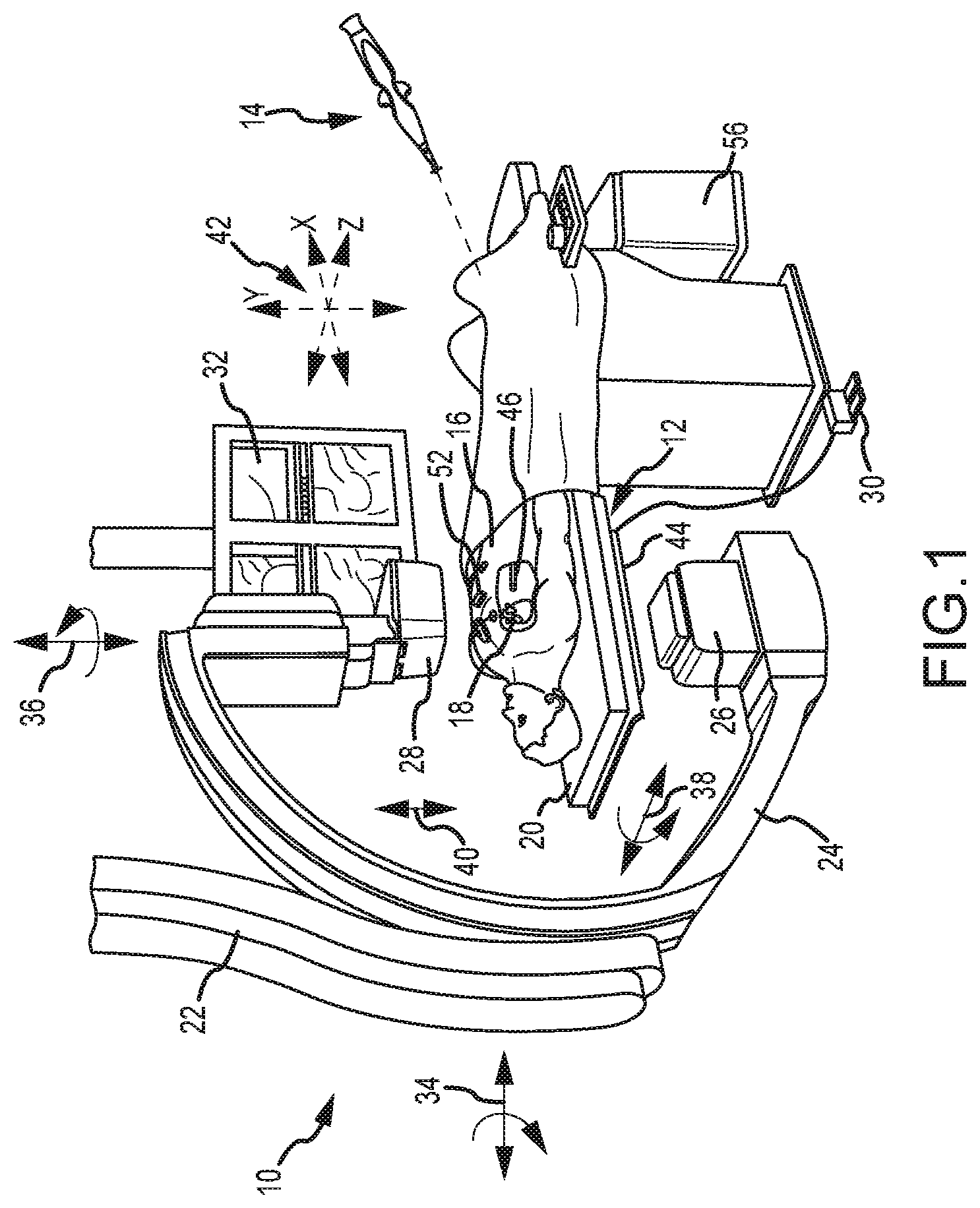 Patent US11771337 Figure 1 – Magnetic field generator with minimal image occlusion and minimal impact on dimensions in c-arm x-ray environments