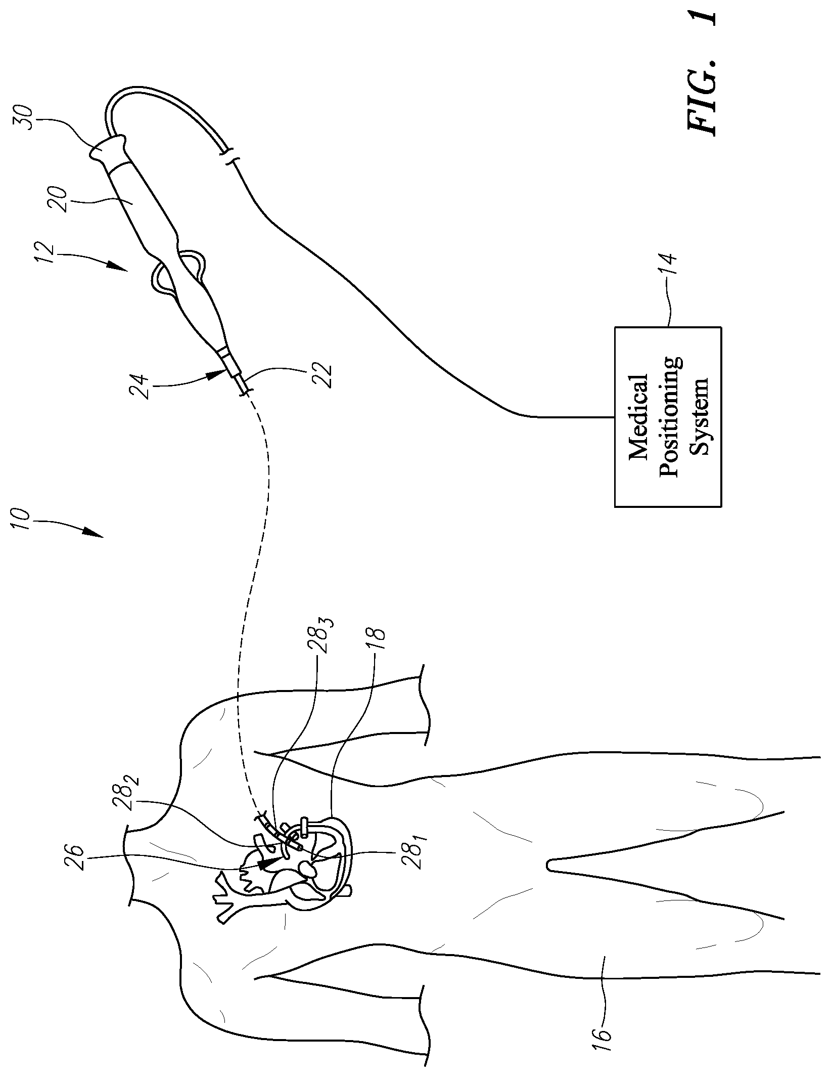 Patent US11771338 Figure 1 – Localized magnetic field generator