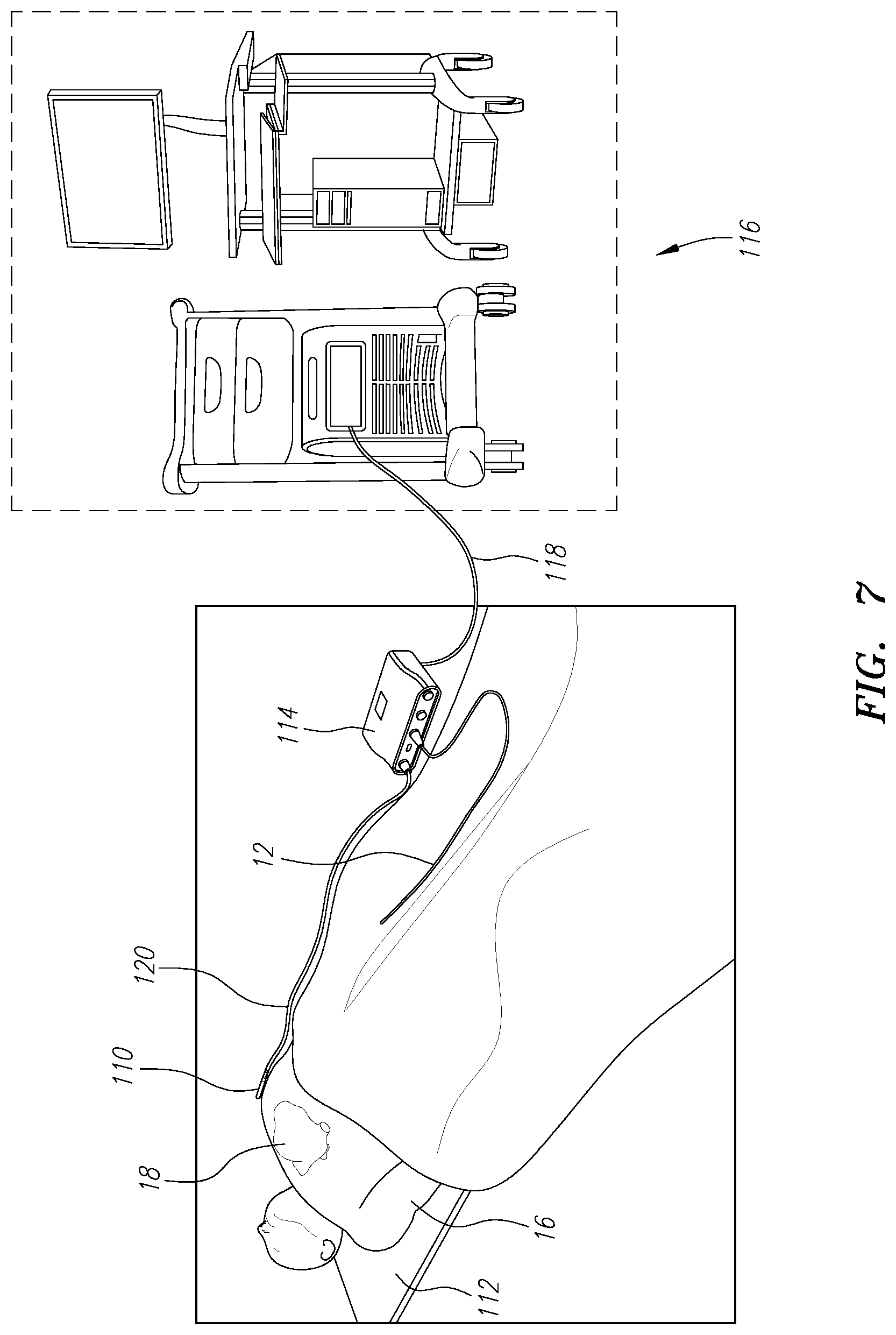 Patent US11771338 Figure 7 – Localized magnetic field generator