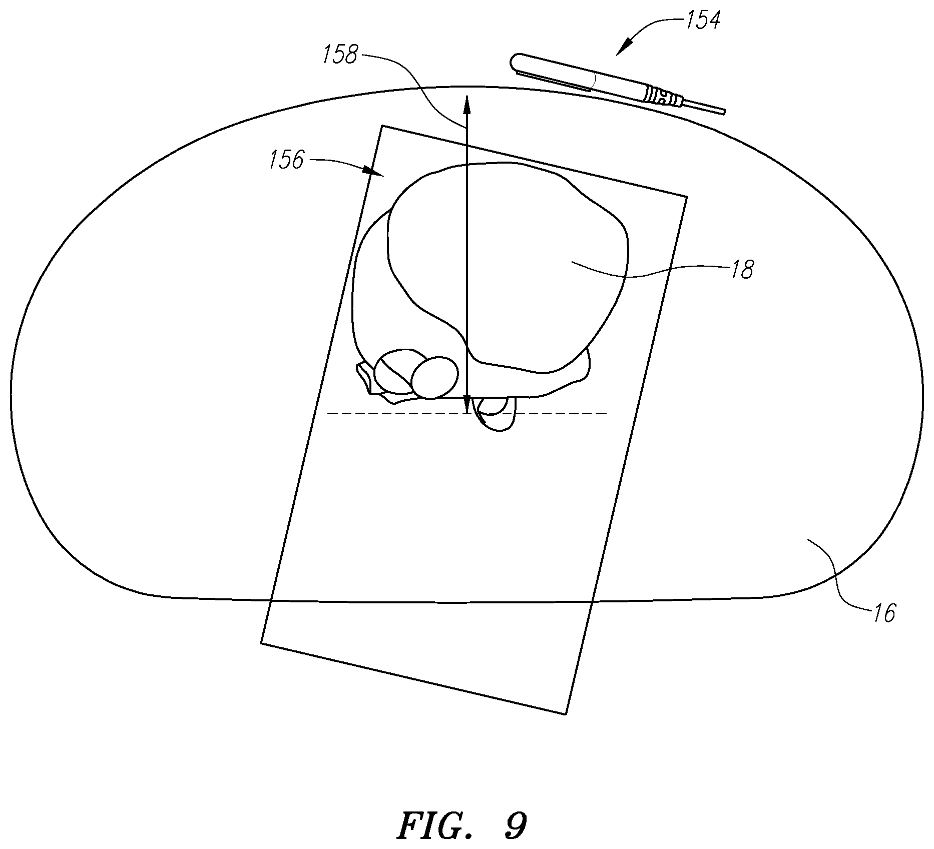 Patent US11771338 Figure 9 – Localized magnetic field generator