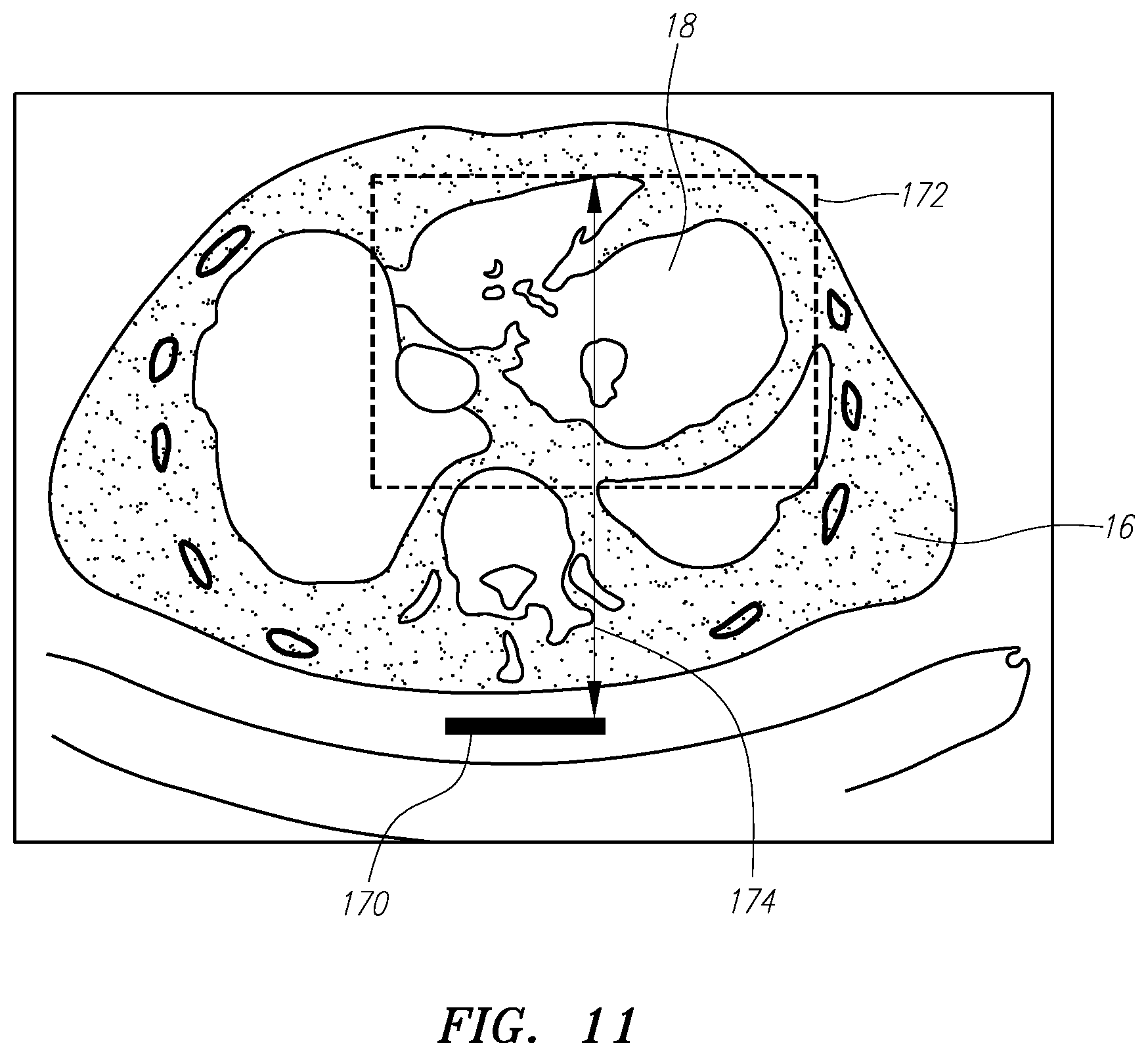 Patent US11771338 Figure 11 – Localized magnetic field generator