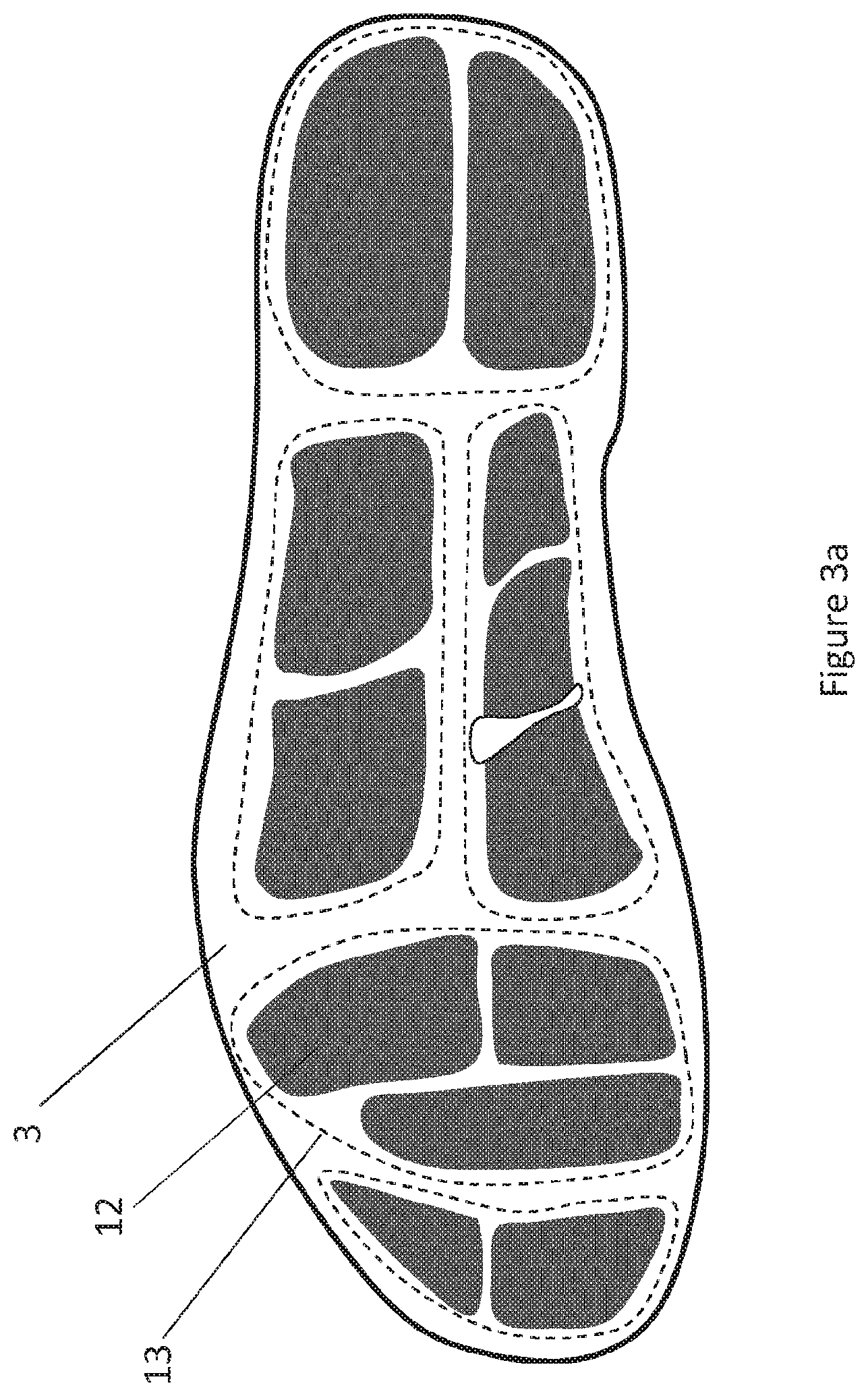 Patent US11771341 Figure 4 – System for determining forces at the feet
