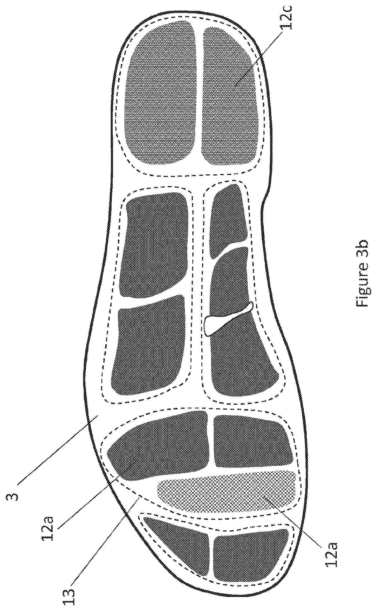 Patent US11771341 Figure 5 – System for determining forces at the feet