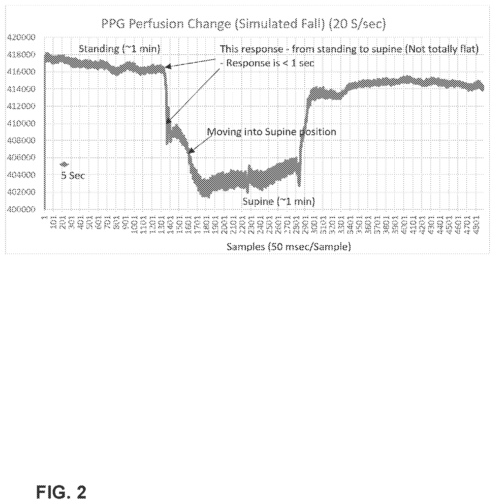 Patent US11771343 Figure 2 – Fall detection using photoplethysmography detectors in ear-wearable devices