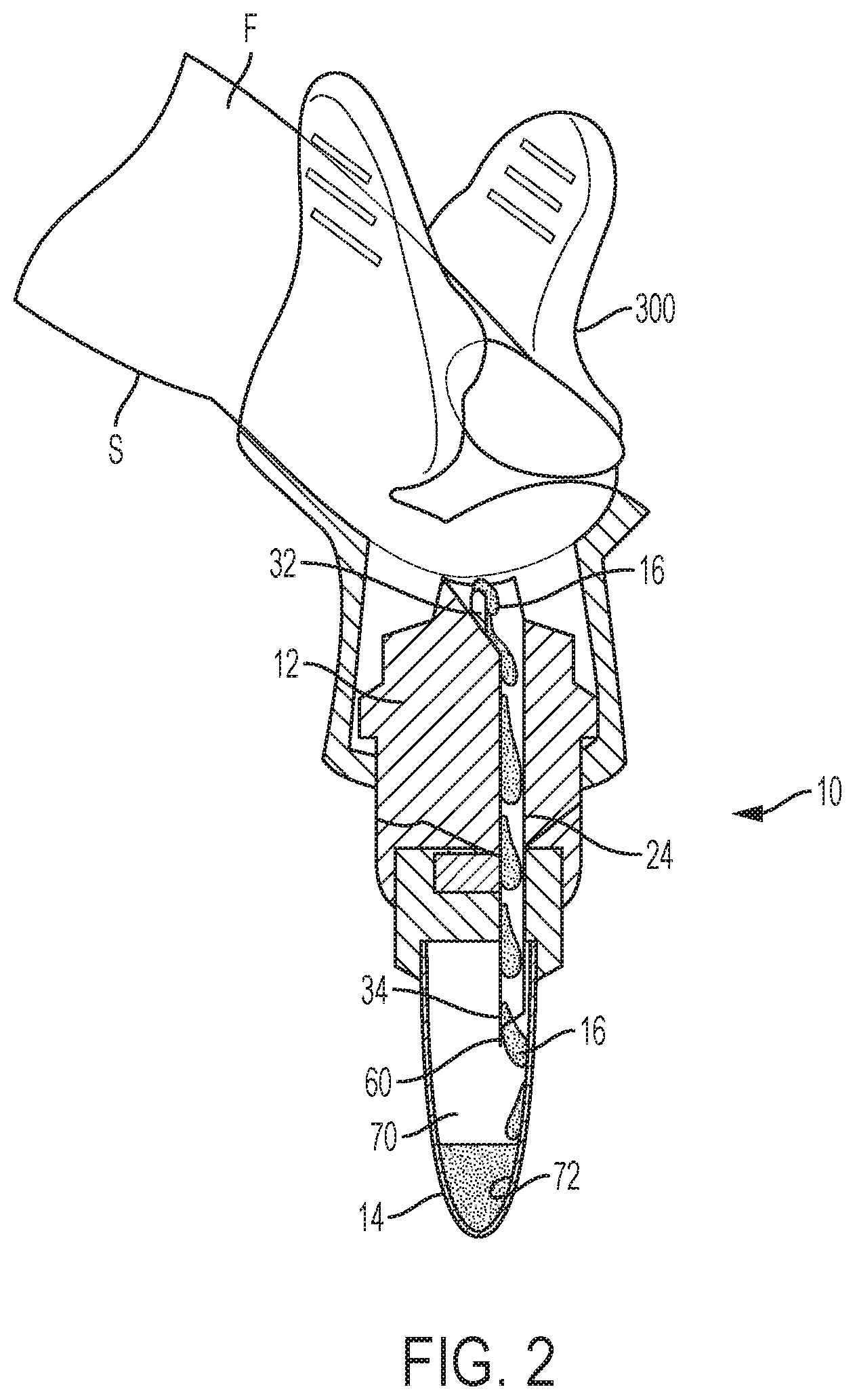 Patent US11771352 Figure 2 – Device for the attached flow of blood