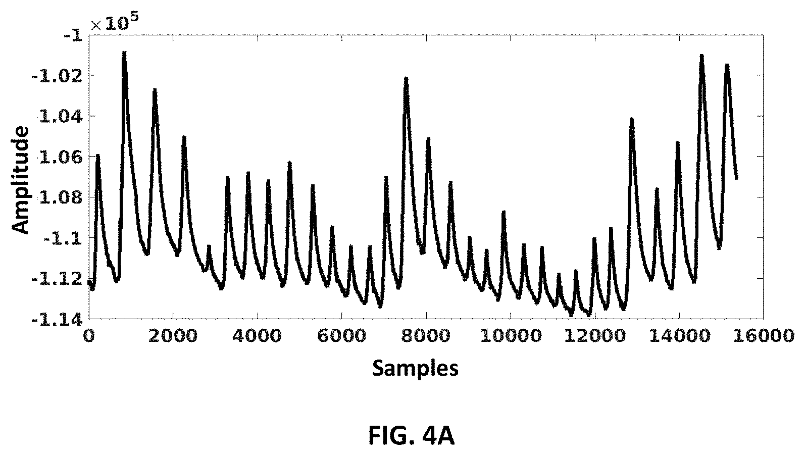 Patent US11771353 Figure 4 – Stress level monitoring of users using a respiratory signal and alerting thereof