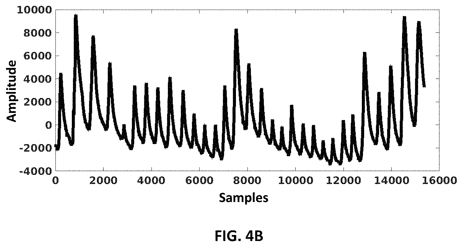 Patent US11771353 Figure 5 – Stress level monitoring of users using a respiratory signal and alerting thereof
