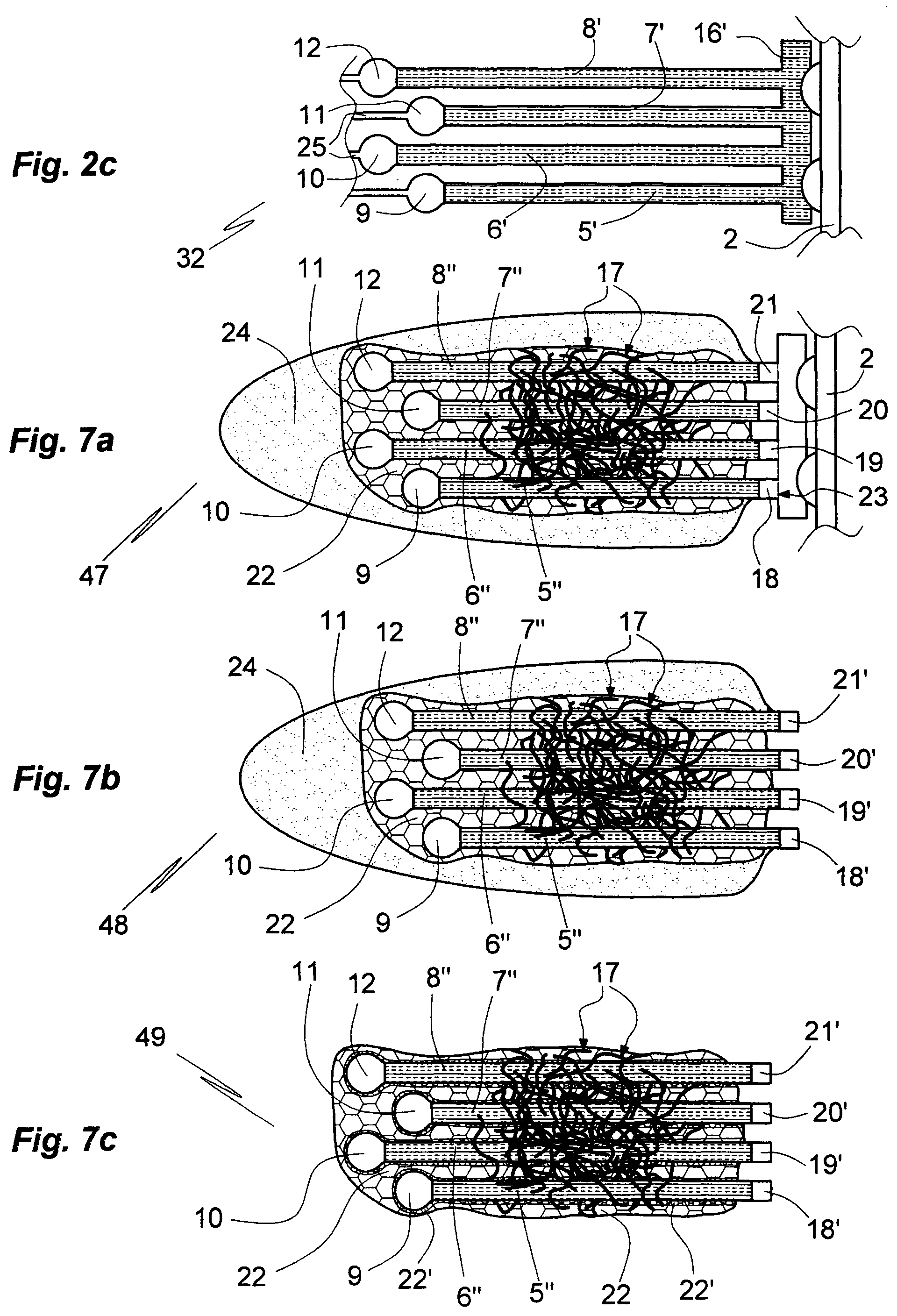 Patent US11771356 Figure 3 – Microelectrode array comprising connecting microfibers