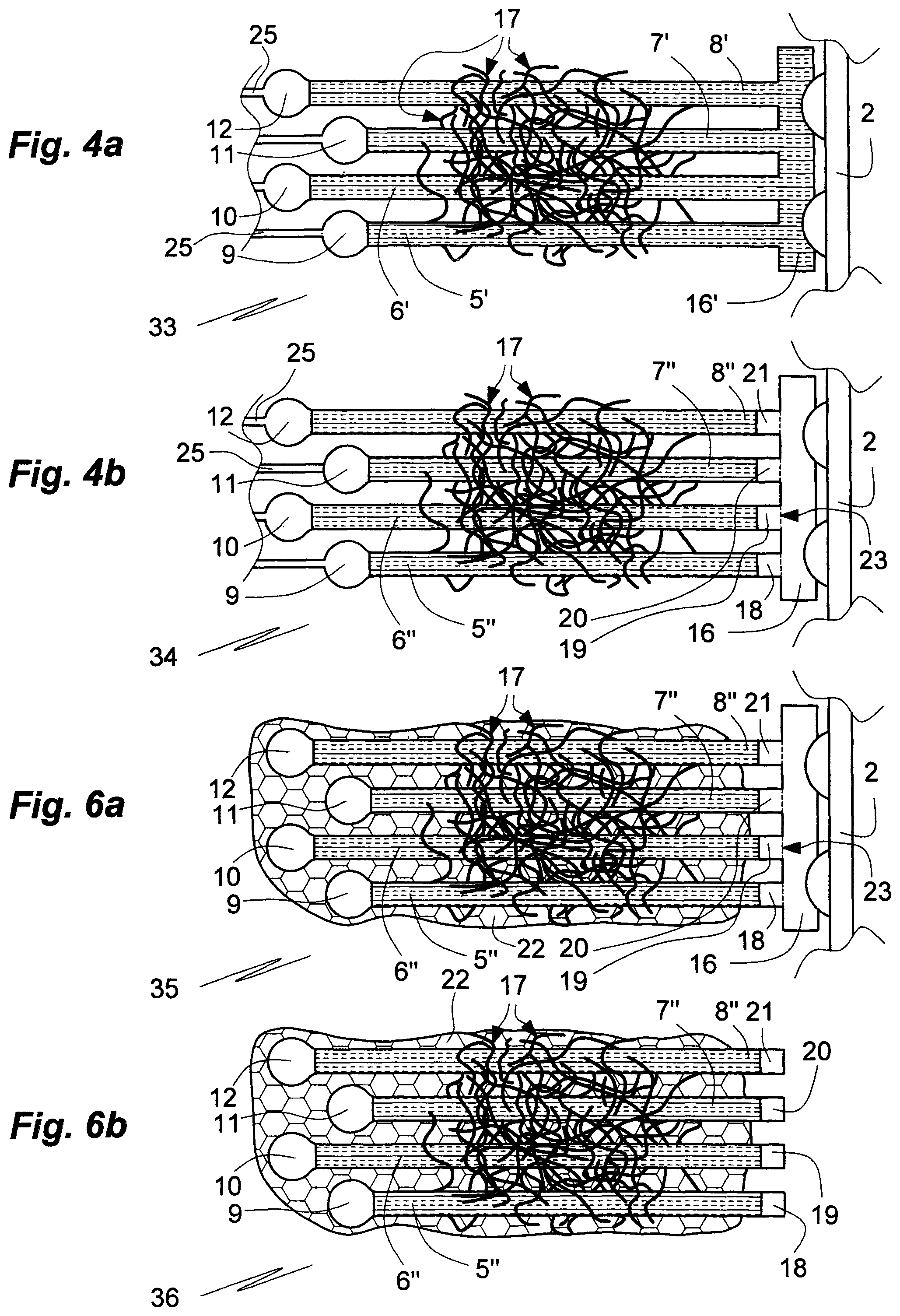 Patent US11771356 Figure 4 – Microelectrode array comprising connecting microfibers