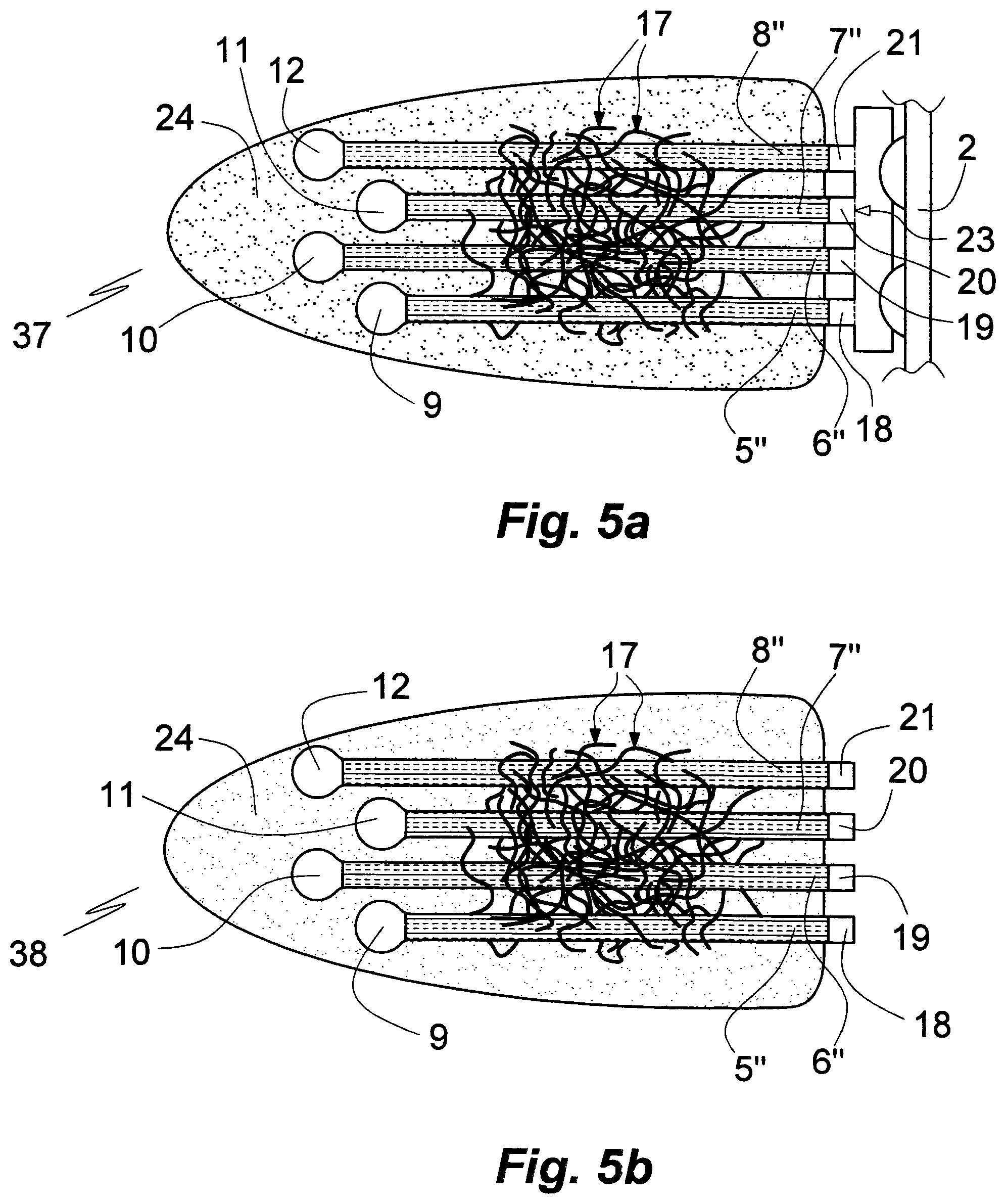 Patent US11771356 Figure 6 – Microelectrode array comprising connecting microfibers