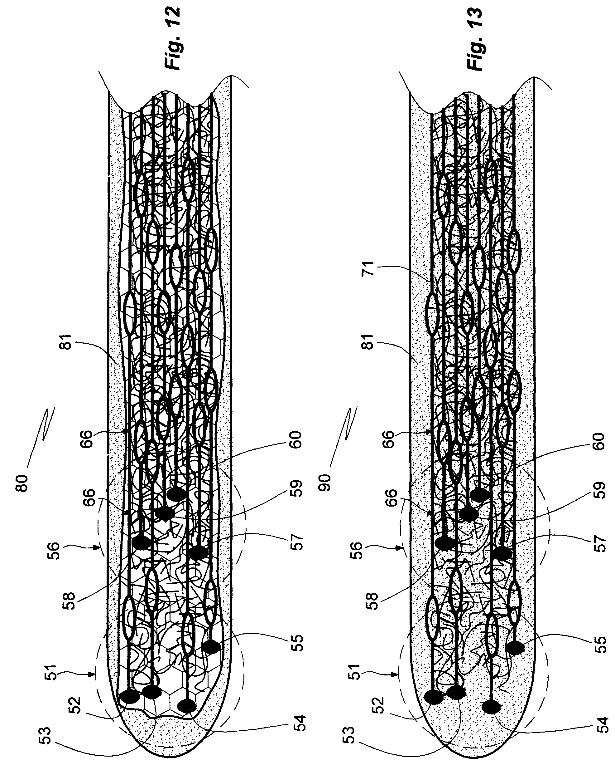 Patent US11771356 Figure 8 – Microelectrode array comprising connecting microfibers