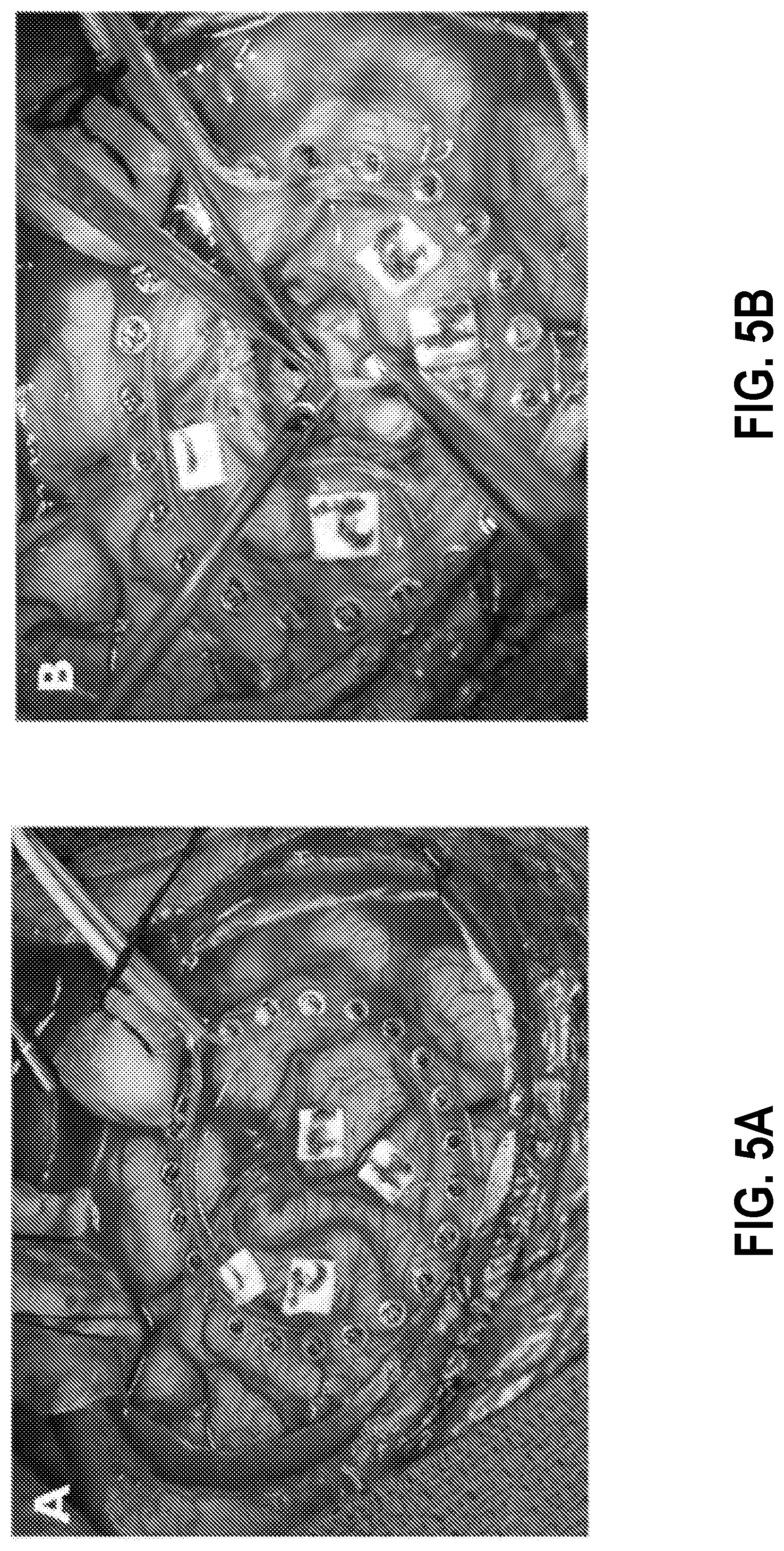 Patent US11771357 Figure 6 – Ring-shaped cortical electrode assembly