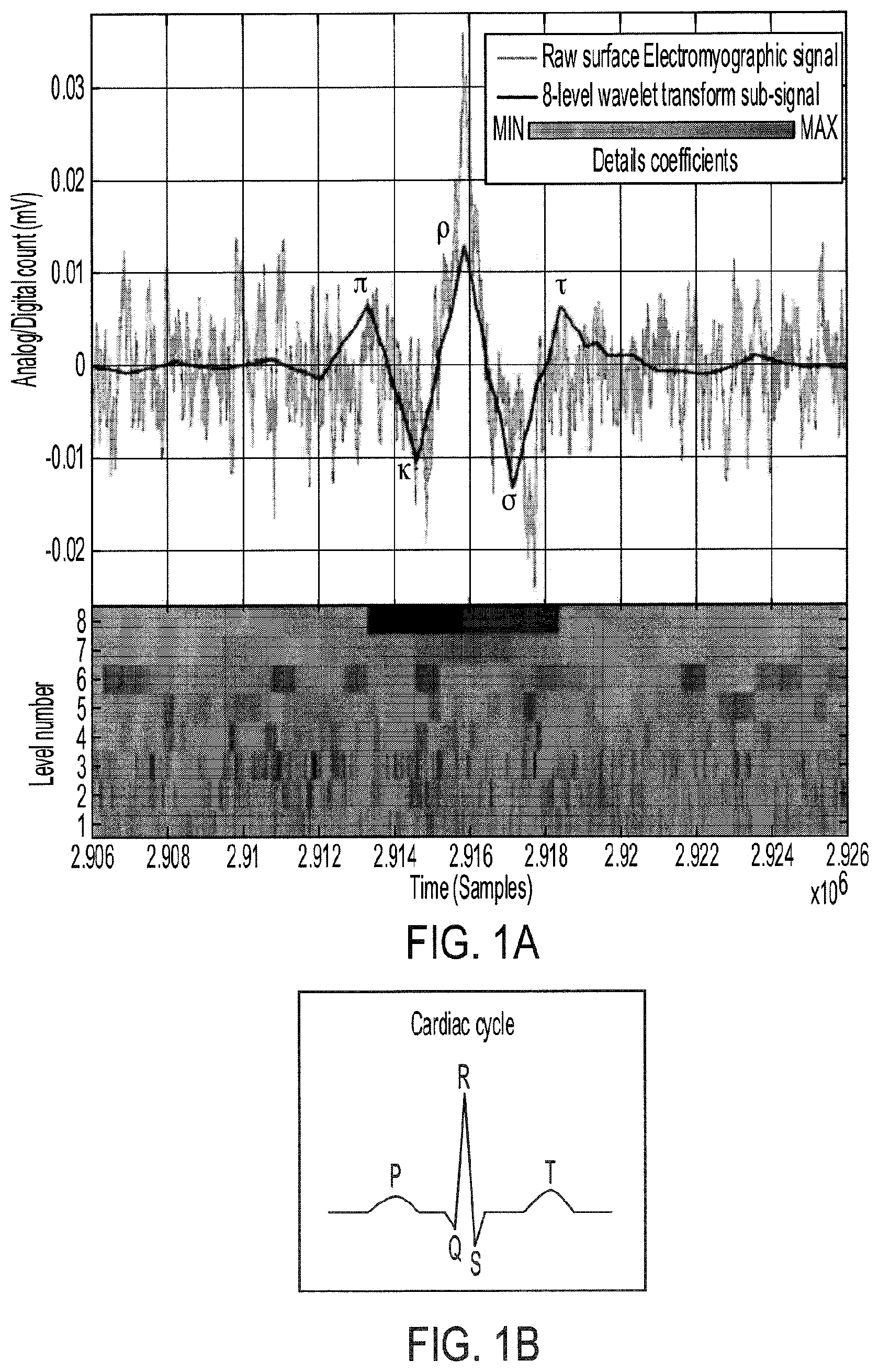 Patent US11771358 Figure 1 – Rhythmic synchronization of motor neuron discharges and their burst rate variability