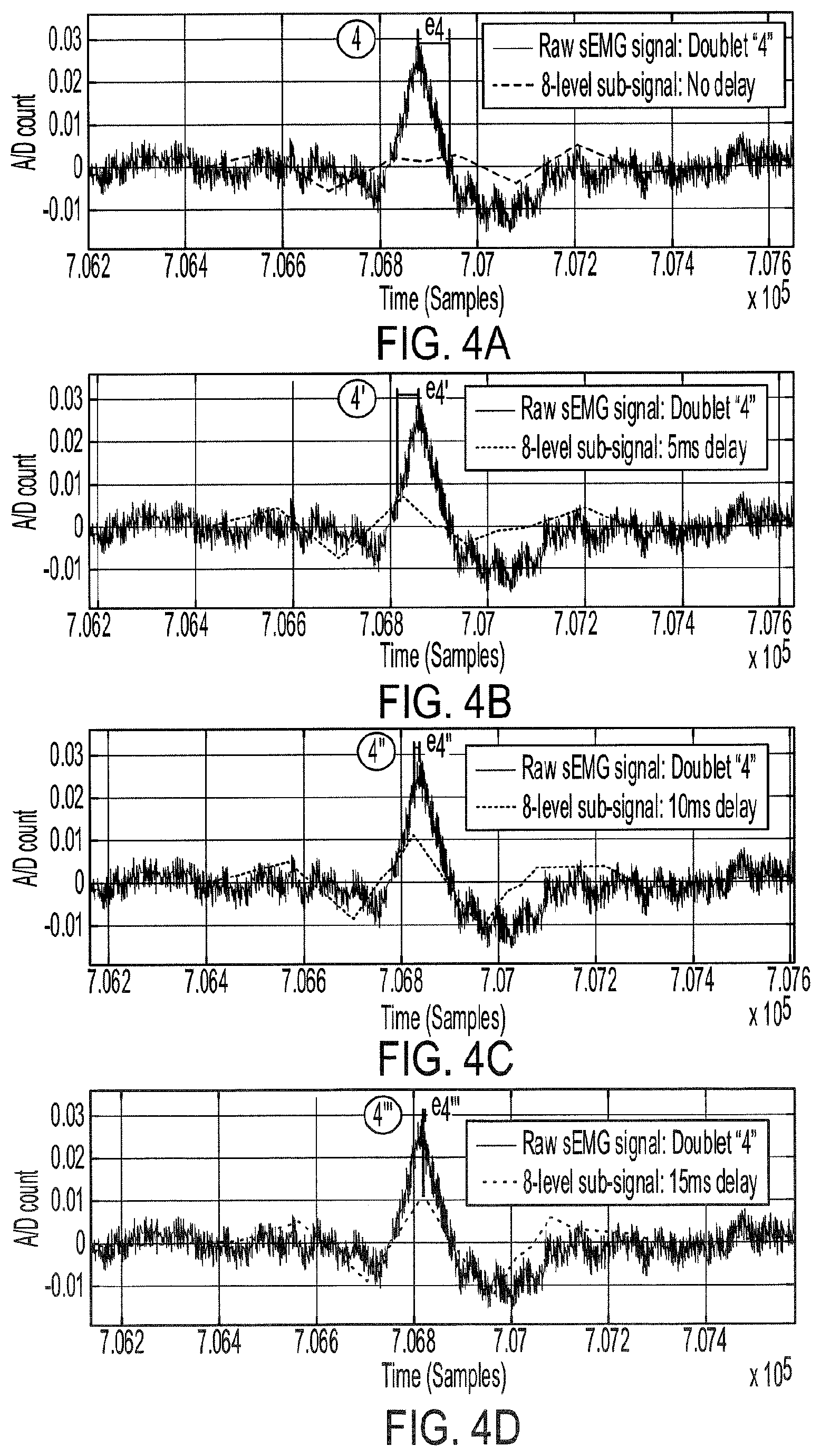 Patent US11771358 Figure 4 – Rhythmic synchronization of motor neuron discharges and their burst rate variability