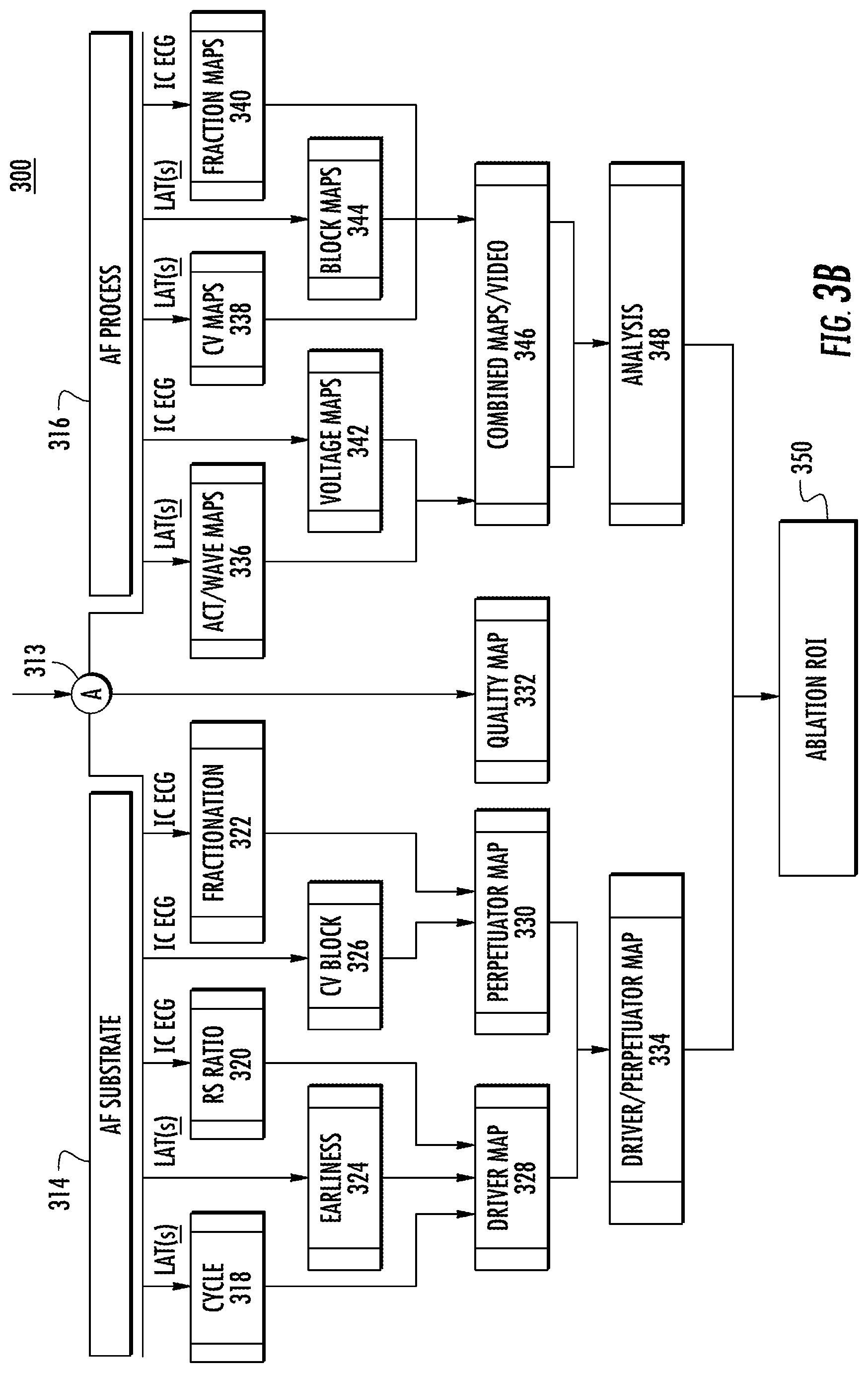 Patent US11771359 Figure 4 – Region of interest focal source detection using comparisons of R-S wave magnitudes and LATs of RS complexes