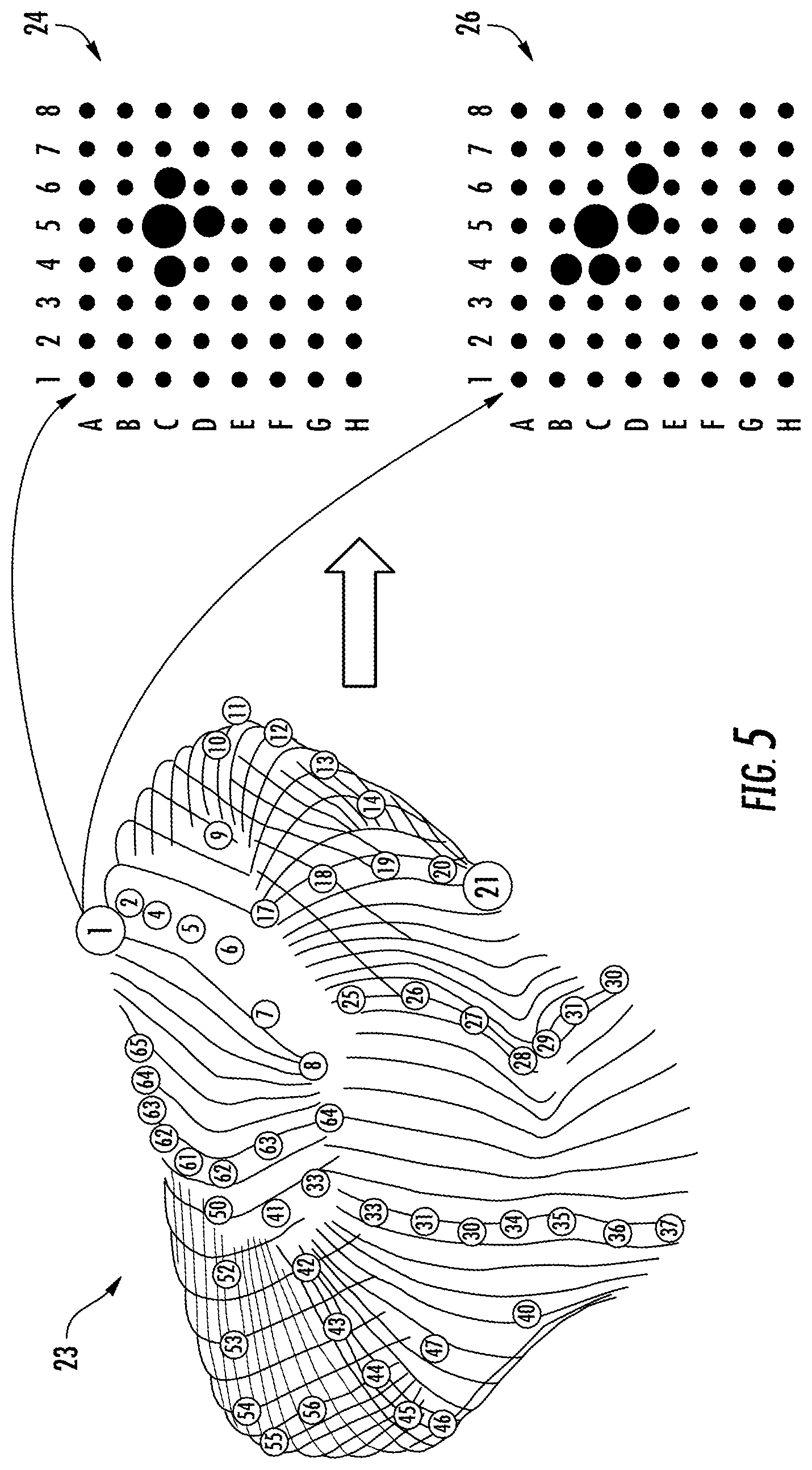 Patent US11771359 Figure 6 – Region of interest focal source detection using comparisons of R-S wave magnitudes and LATs of RS complexes