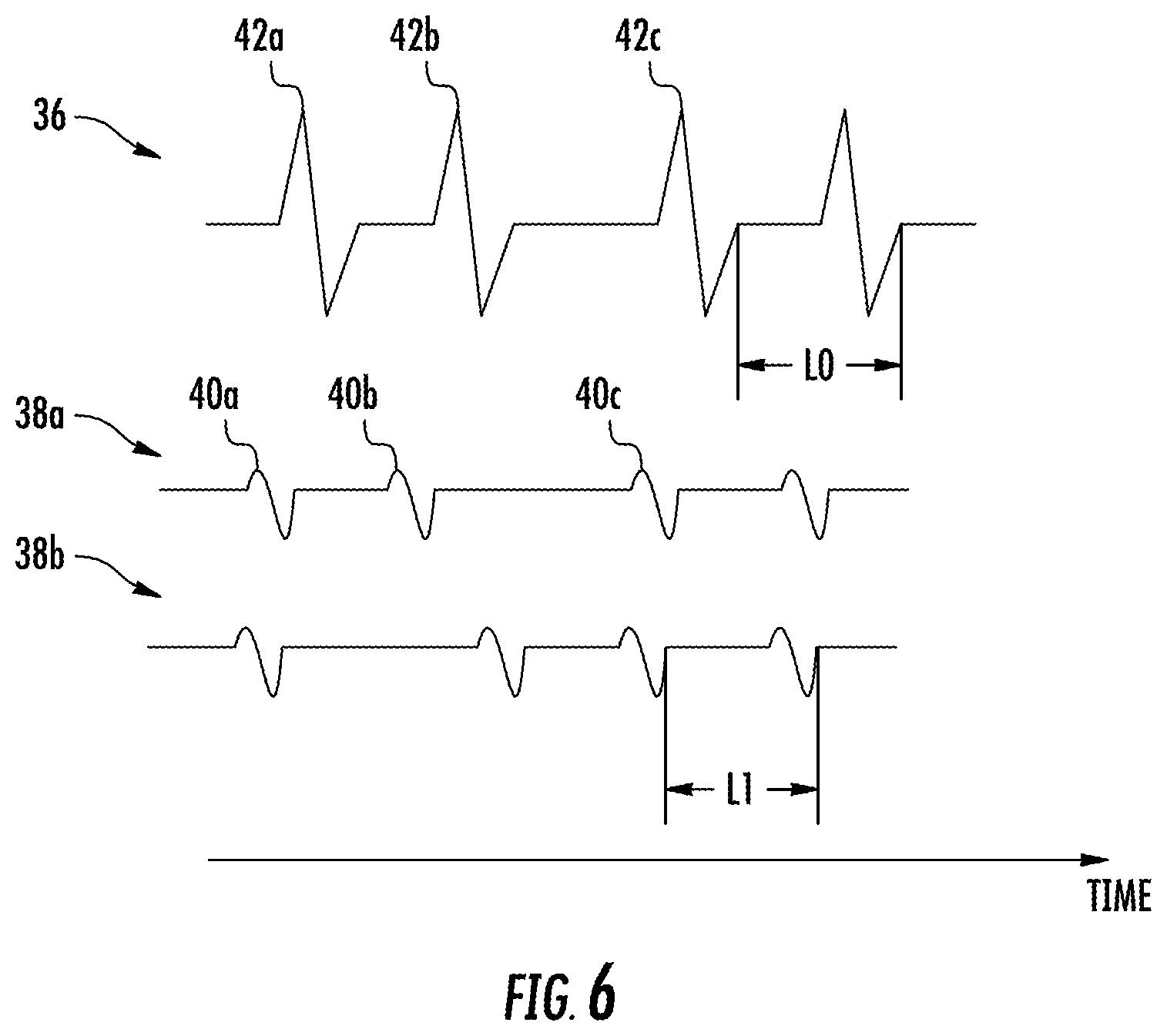 Patent US11771359 Figure 7 – Region of interest focal source detection using comparisons of R-S wave magnitudes and LATs of RS complexes
