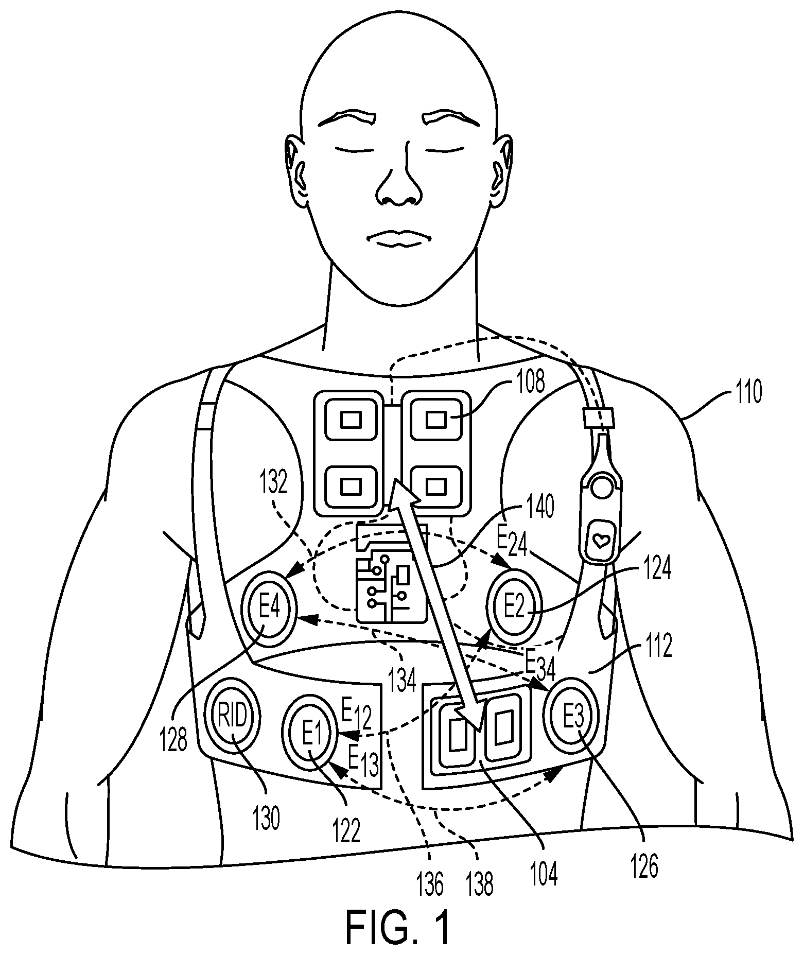 Patent US11771360 Figure 1 – Cardiac monitoring system with normally conducted QRS complex identification