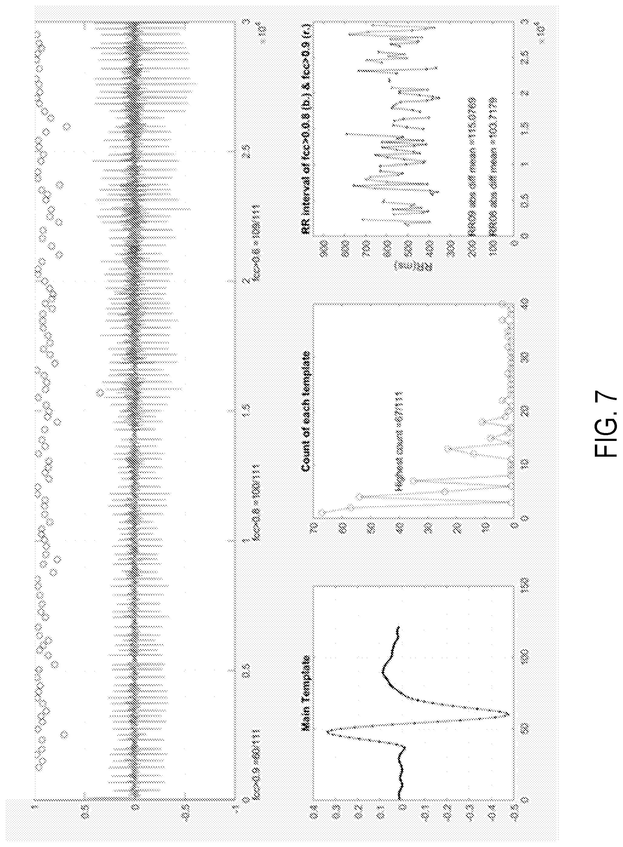 Patent US11771360 Figure 7 – Cardiac monitoring system with normally conducted QRS complex identification