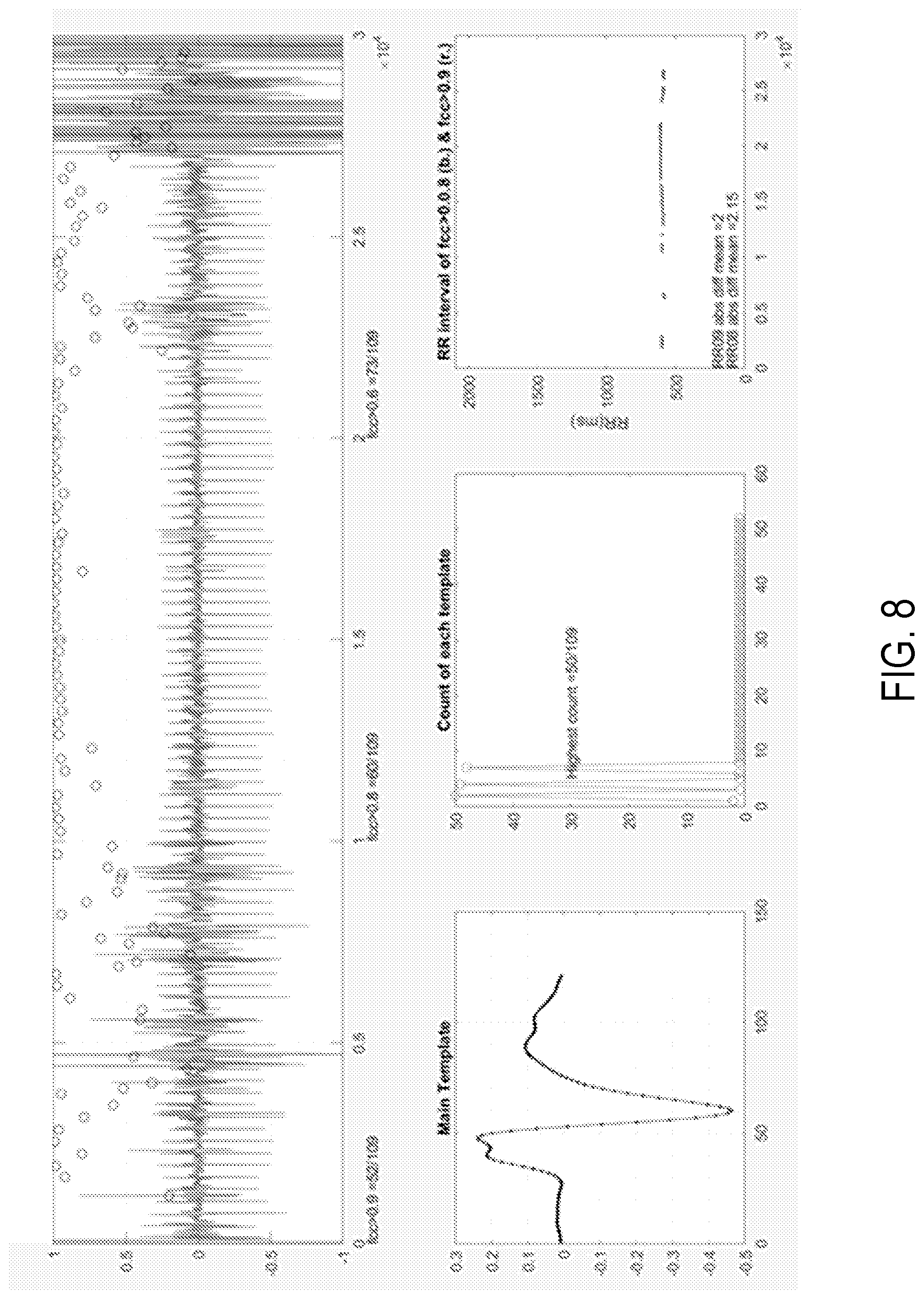 Patent US11771360 Figure 8 – Cardiac monitoring system with normally conducted QRS complex identification