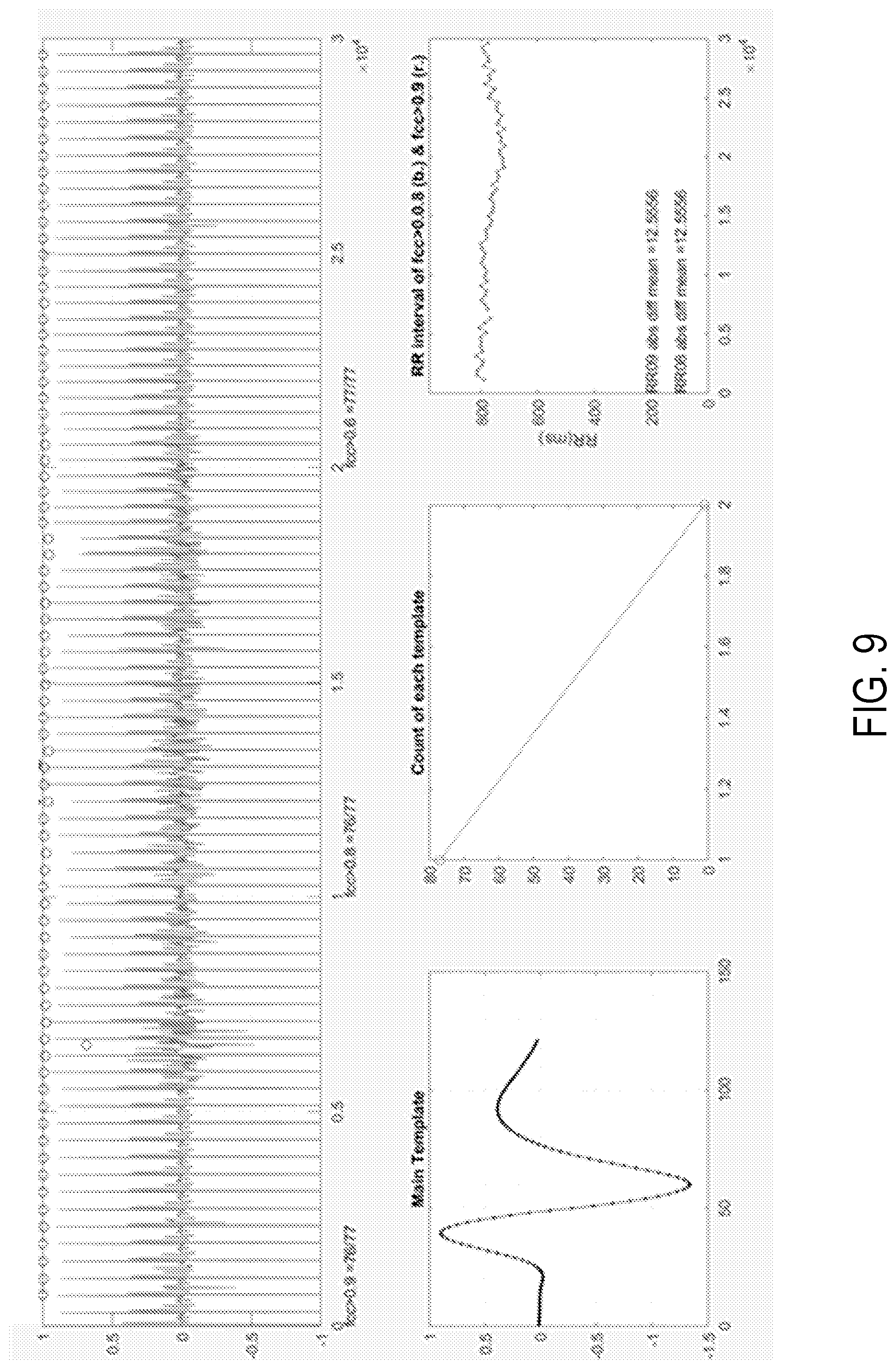 Patent US11771360 Figure 9 – Cardiac monitoring system with normally conducted QRS complex identification