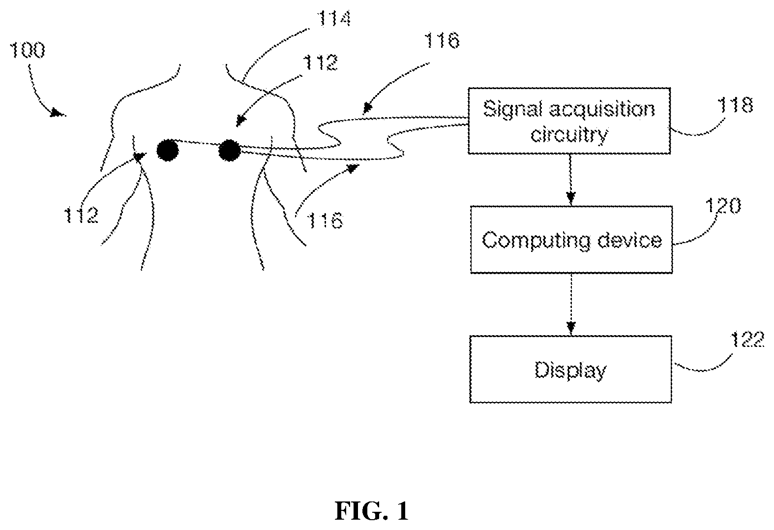 Patent US11771361 — Method and system for determining QRS onset in cardiac signals — Figure 1