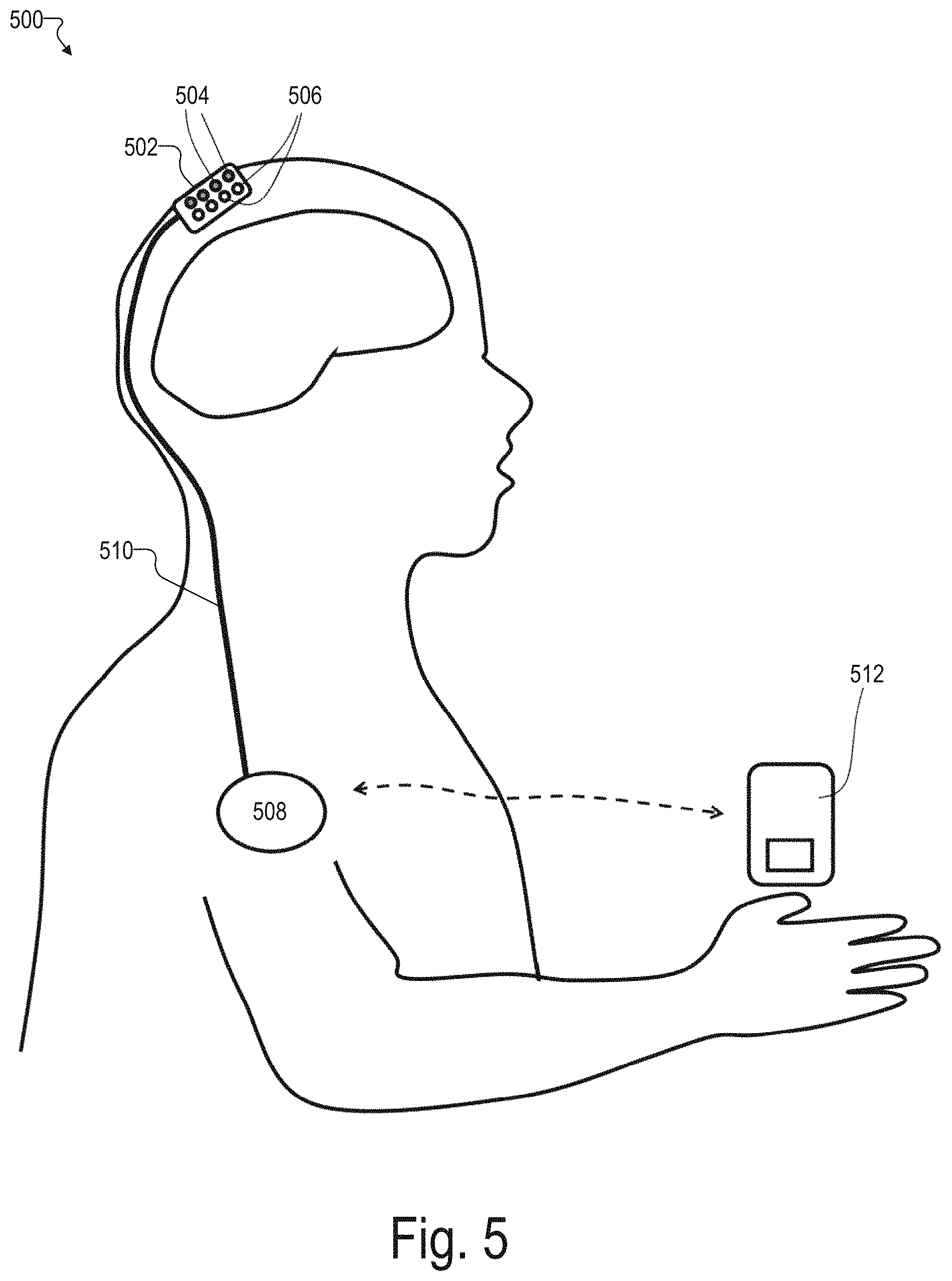 Patent US11771362 Figure 5 – Integrated detector assemblies for a wearable module of an optical measurement system
