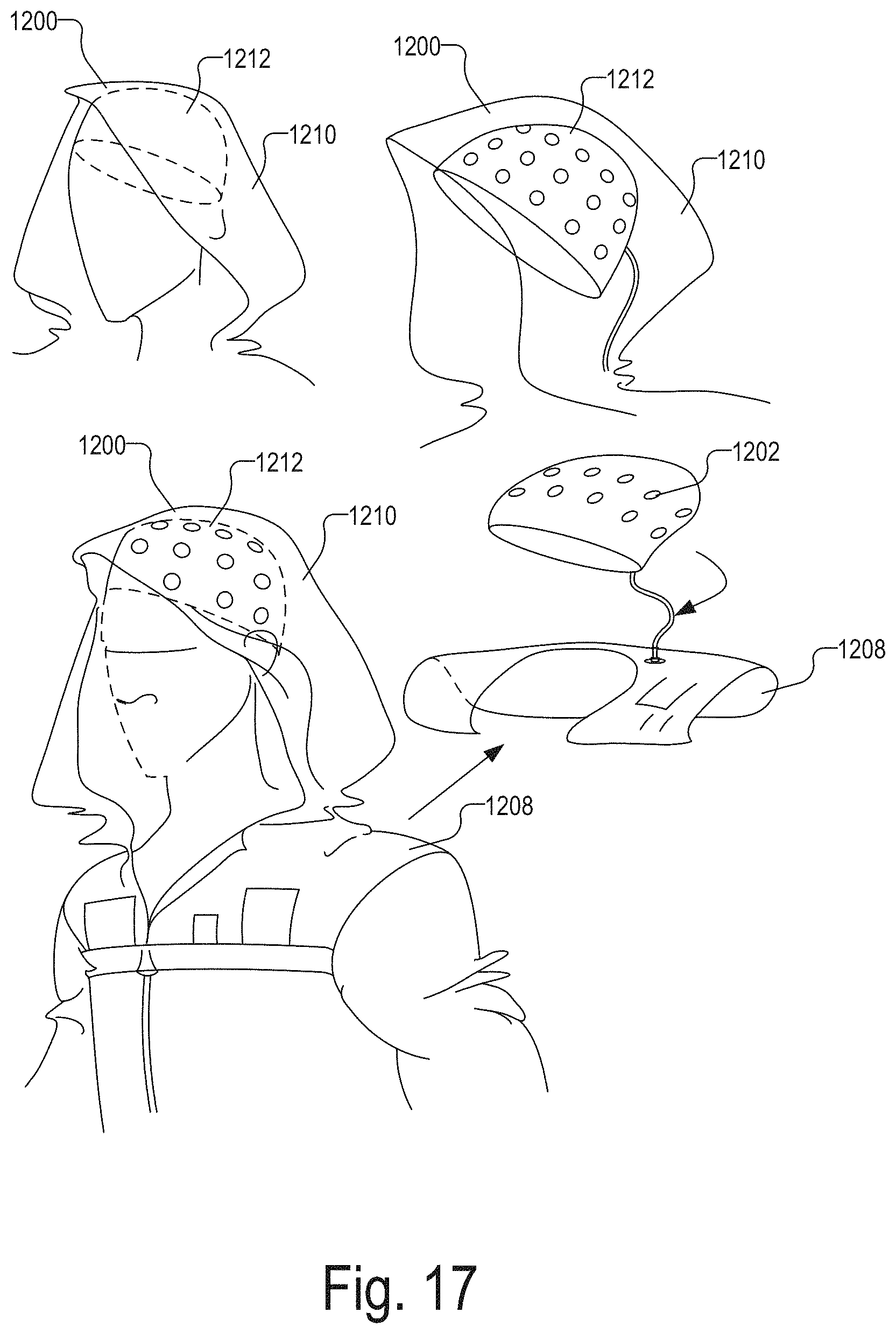 Patent US11771362 Figure 17 – Integrated detector assemblies for a wearable module of an optical measurement system