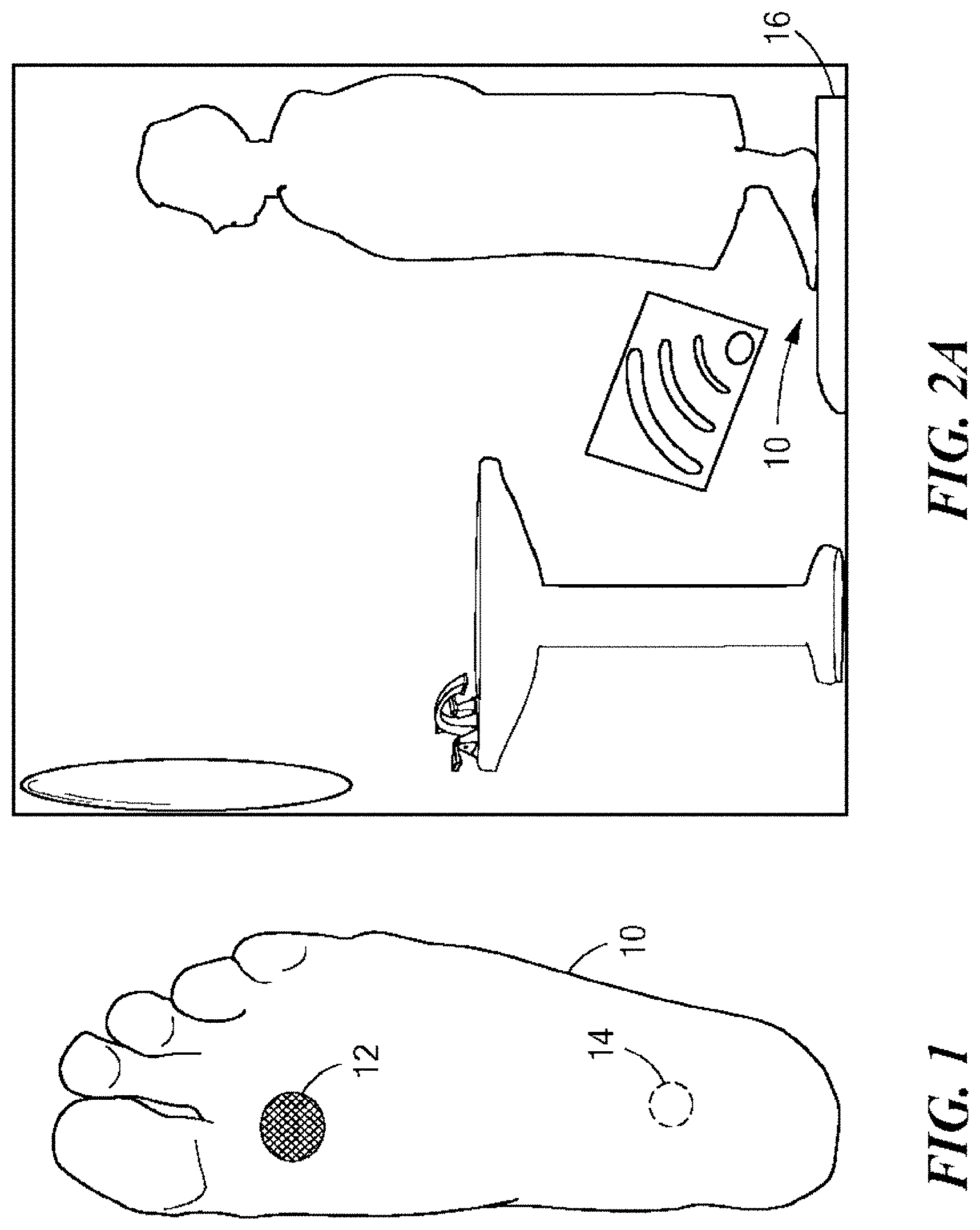 Patent US11771363 Figure 1 – Ipsilateral ulcer and pre-ulcer detection method and apparatus