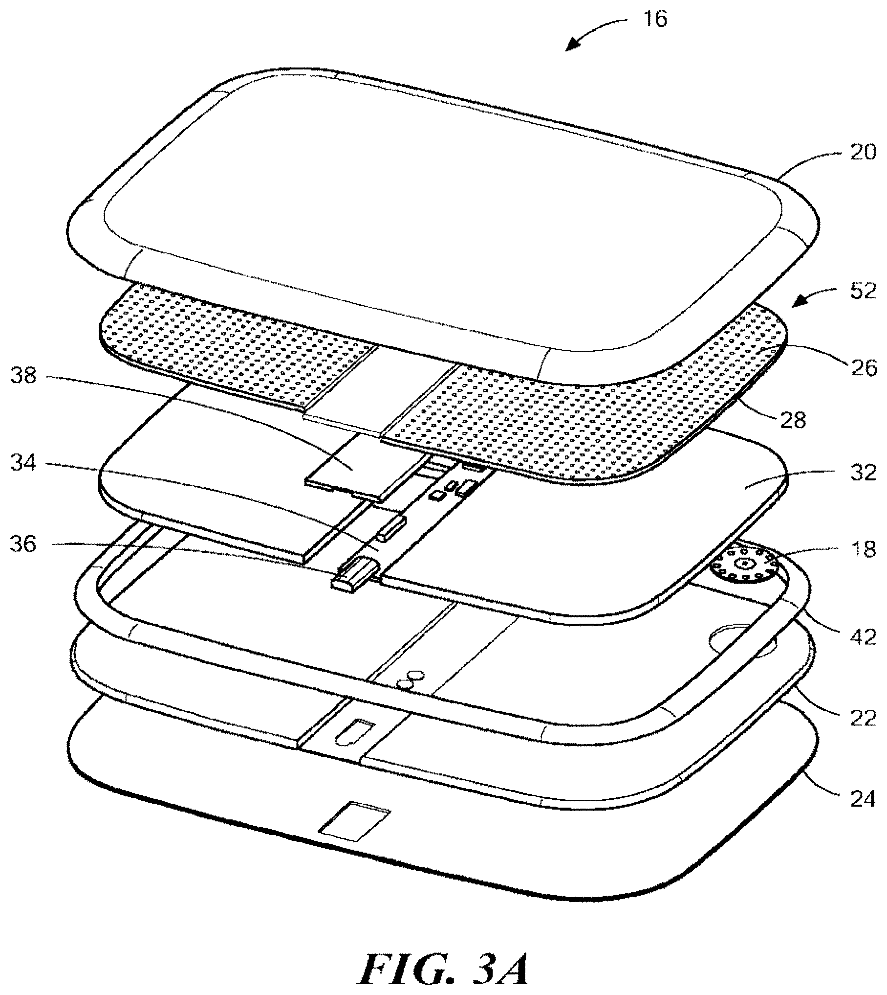 Patent US11771363 Figure 3 – Ipsilateral ulcer and pre-ulcer detection method and apparatus