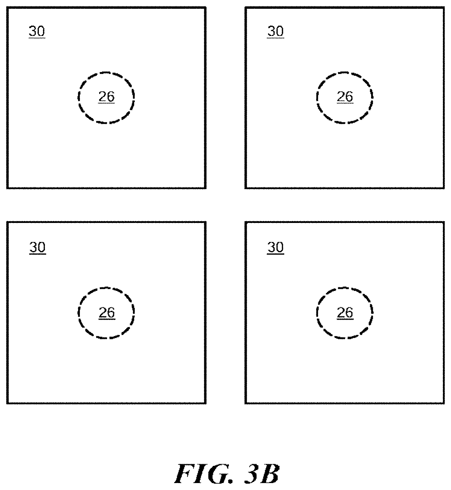 Patent US11771363 Figure 4 – Ipsilateral ulcer and pre-ulcer detection method and apparatus