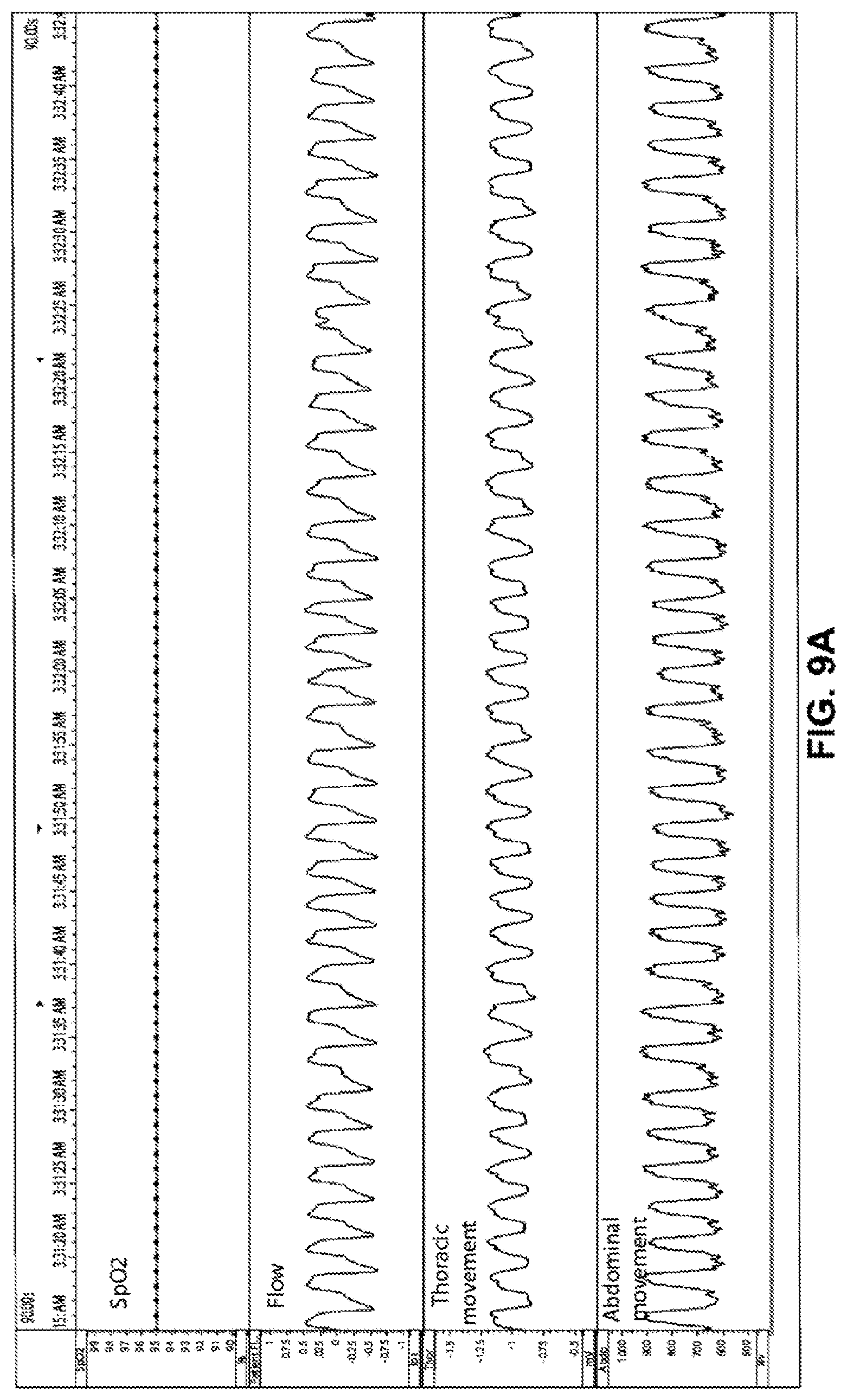 Patent US11771365 Figure 9 – Systems and methods for screening, diagnosis and monitoring sleep-disordered breathing
