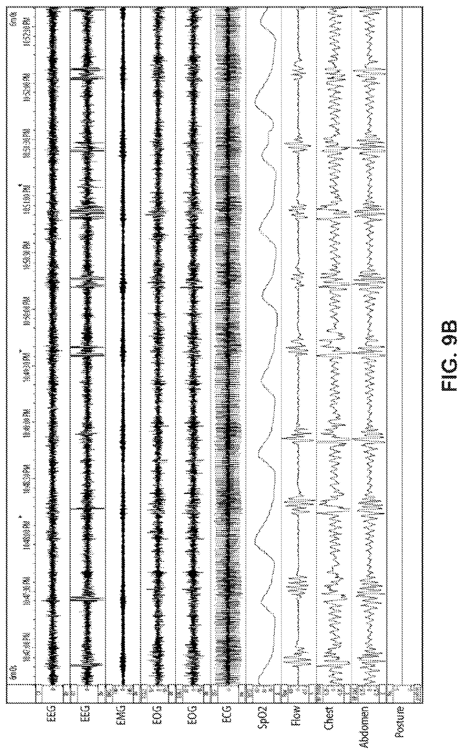 Patent US11771365 Figure 10 – Systems and methods for screening, diagnosis and monitoring sleep-disordered breathing