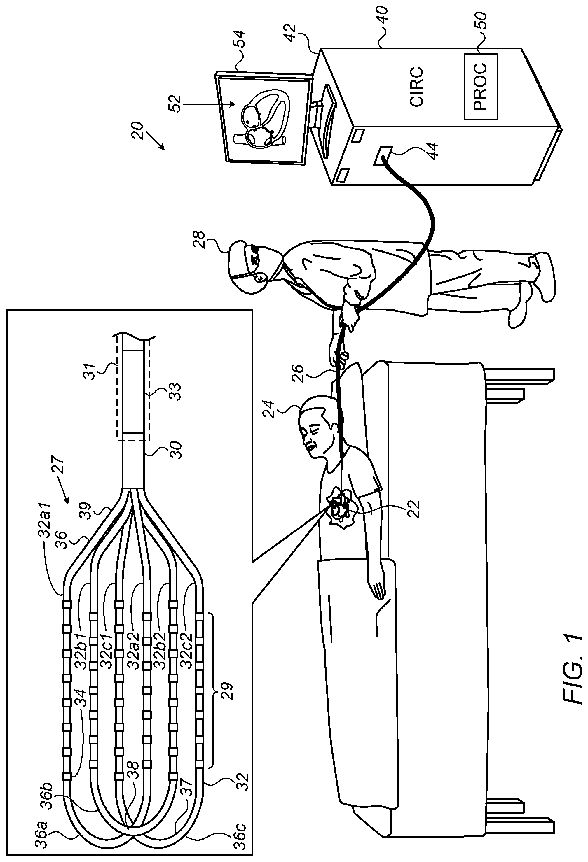 Patent US11771373 Figure 1 – Staggered electrode arrangements for electrophysiological sensing