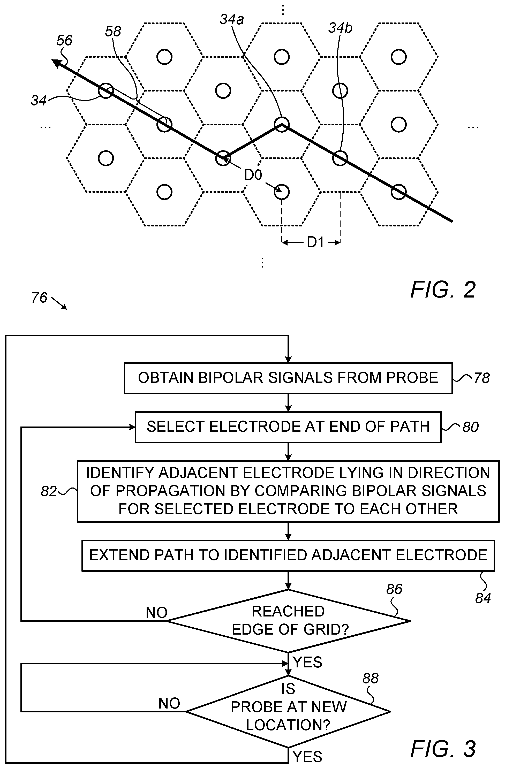 Patent US11771373 Figure 2 – Staggered electrode arrangements for electrophysiological sensing
