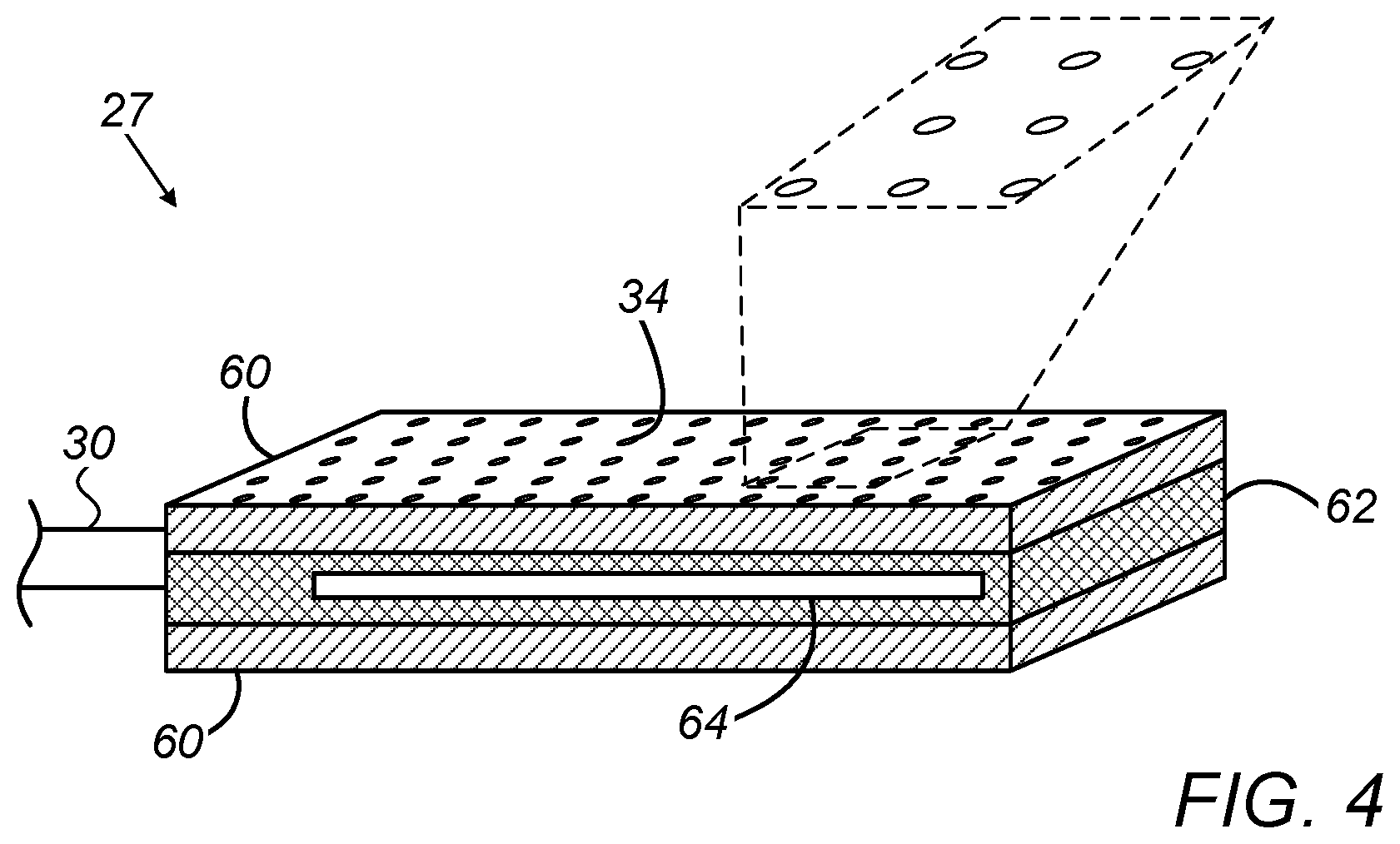 Patent US11771373 Figure 3 – Staggered electrode arrangements for electrophysiological sensing