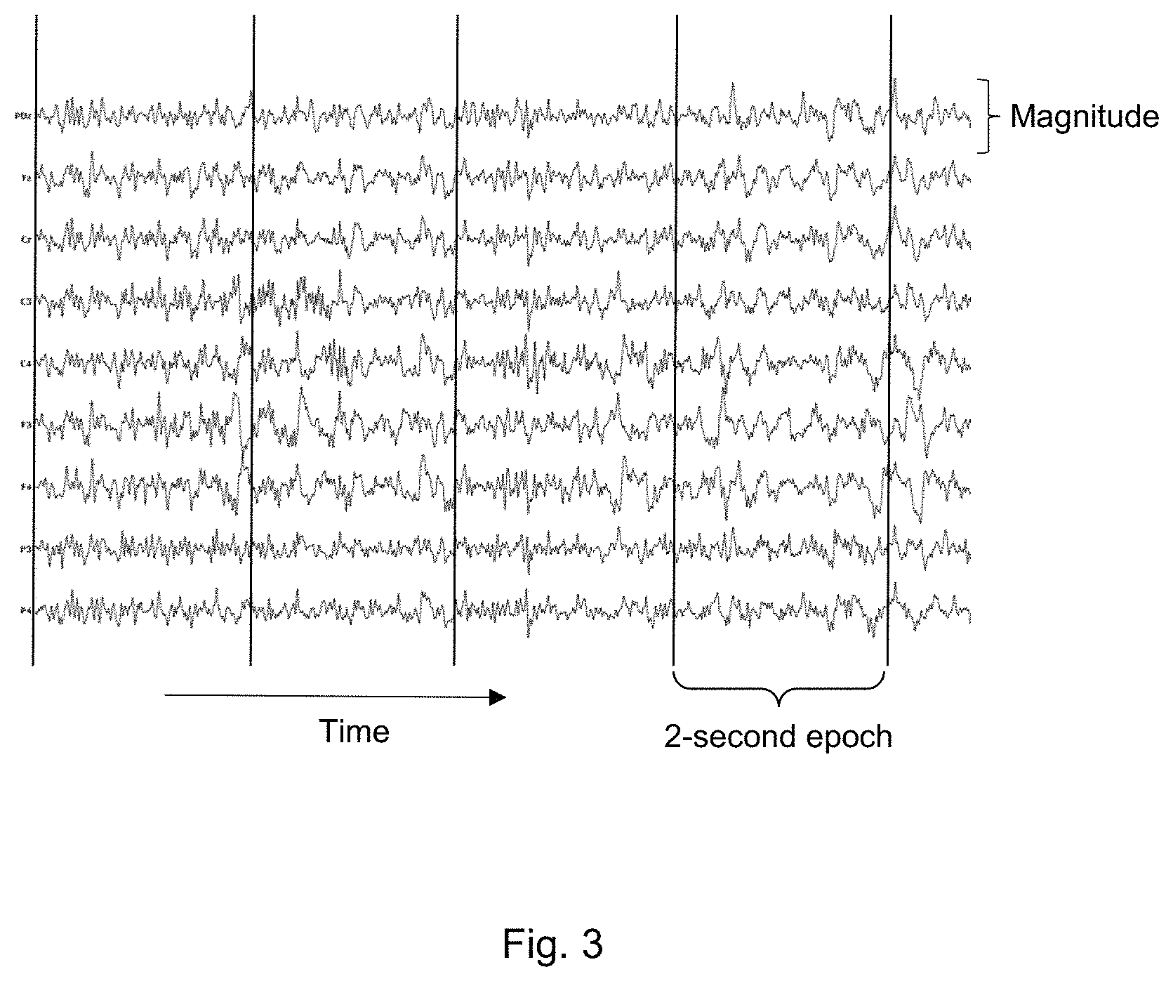Patent US11771377 Figure 3 – Method and system for identifying cohorts of psychiatric disorder patients based on electroencephalograph